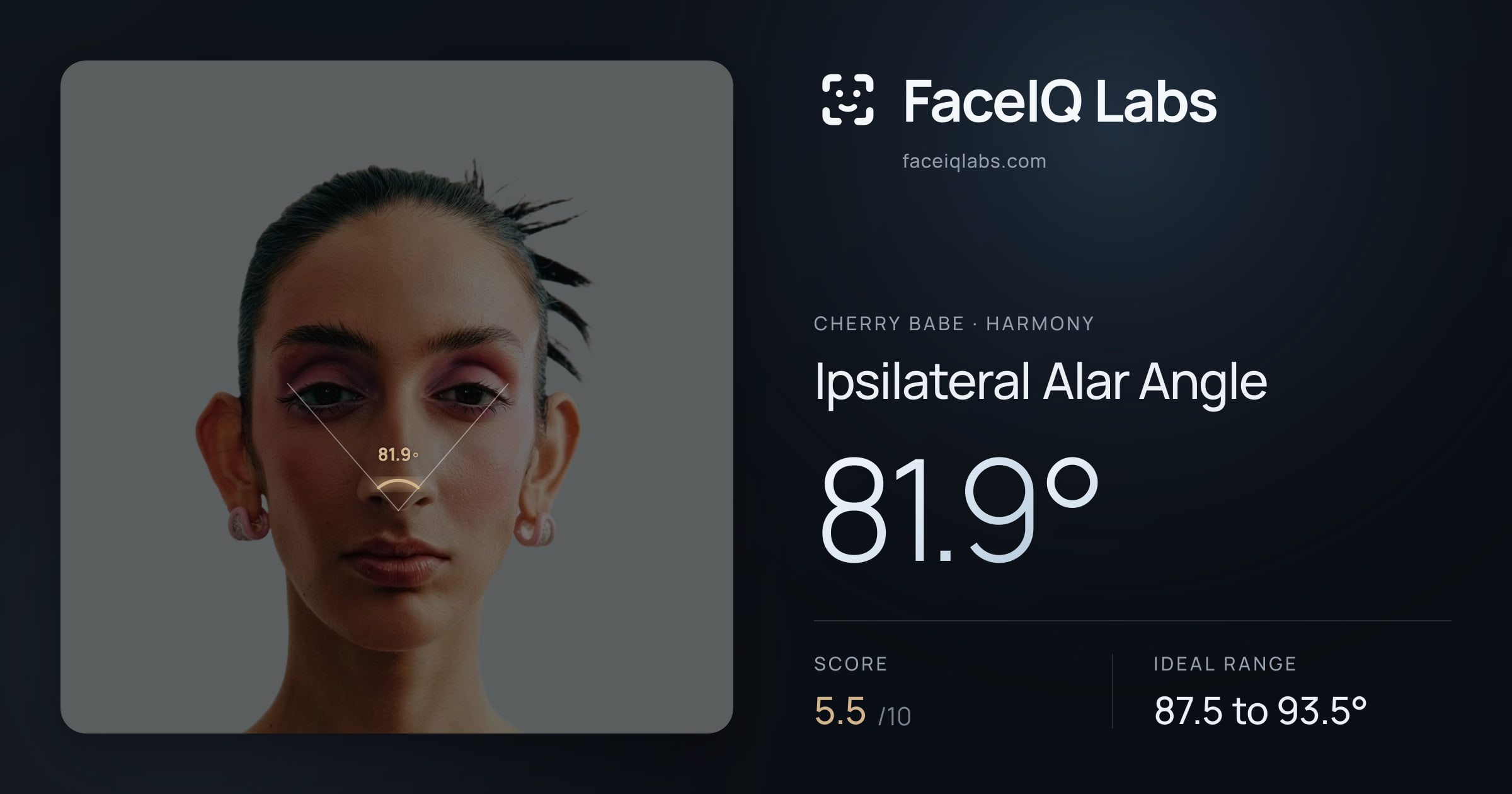 Cherry Babe Ipsilateral Alar Angle: 81.9°, drawn on the photo
