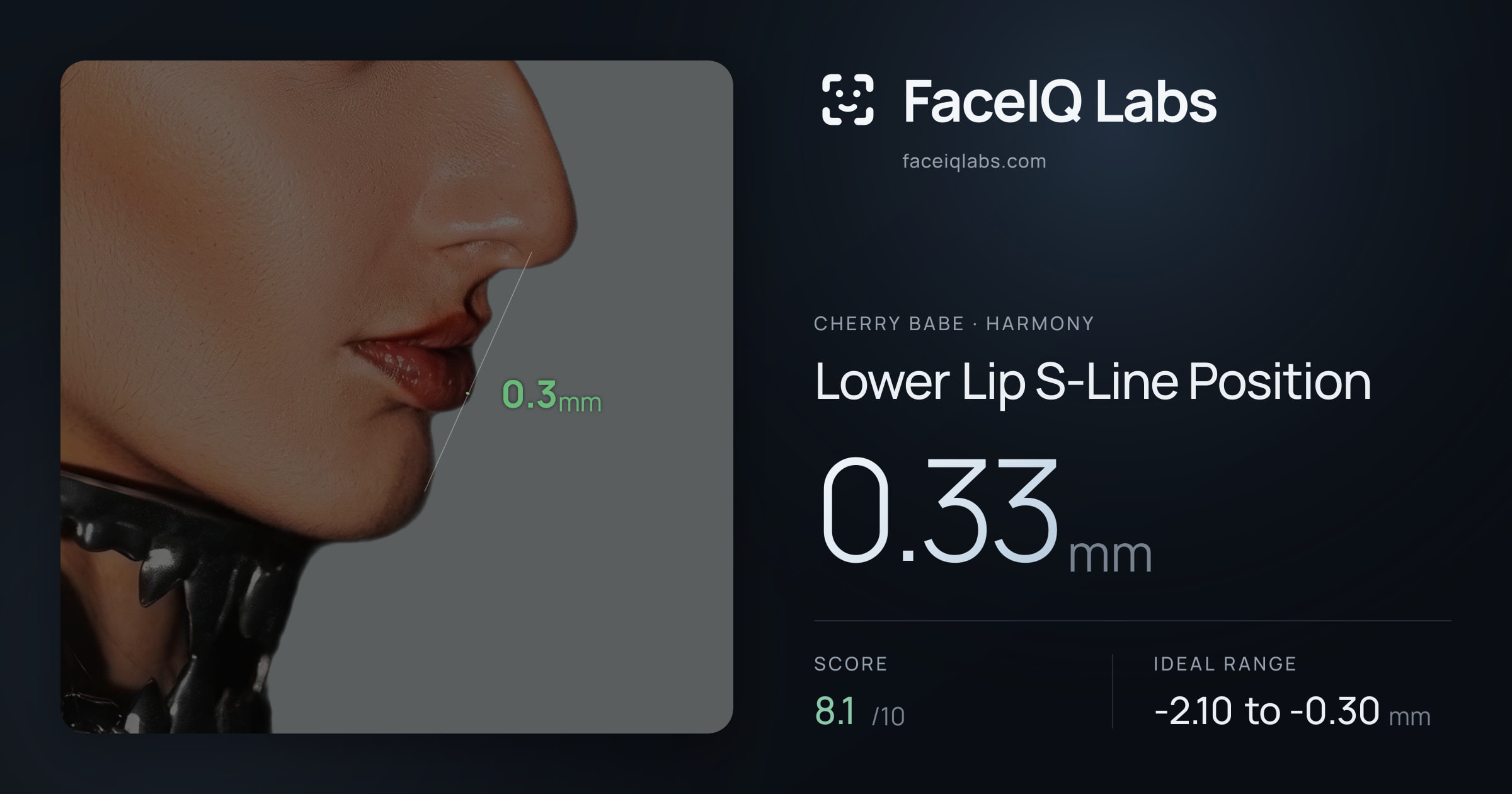Cherry Babe Lower Lip S-Line Position: 0.33mm, drawn on the photo