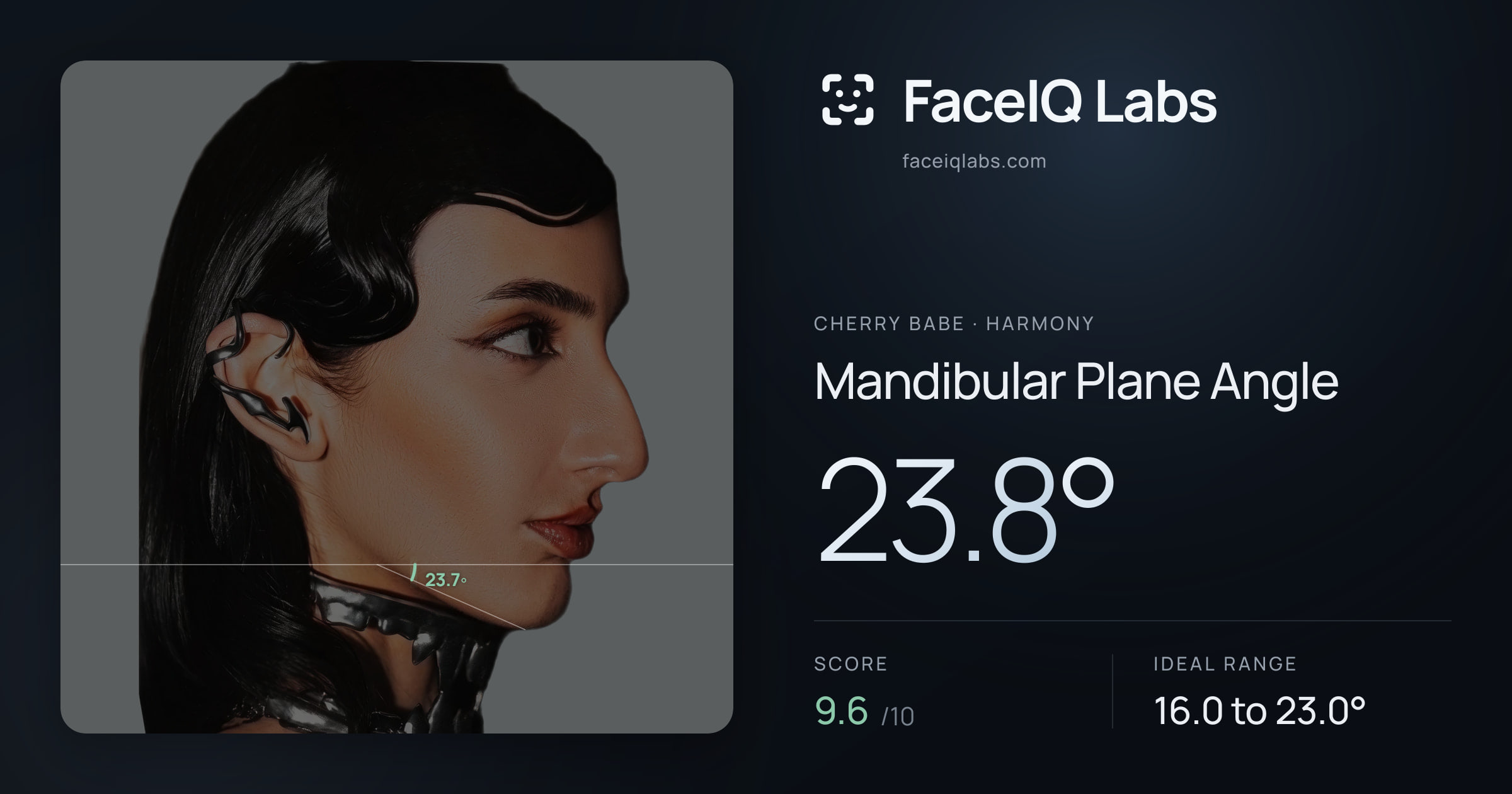 Cherry Babe Mandibular Plane Angle: 23.8°, drawn on the photo