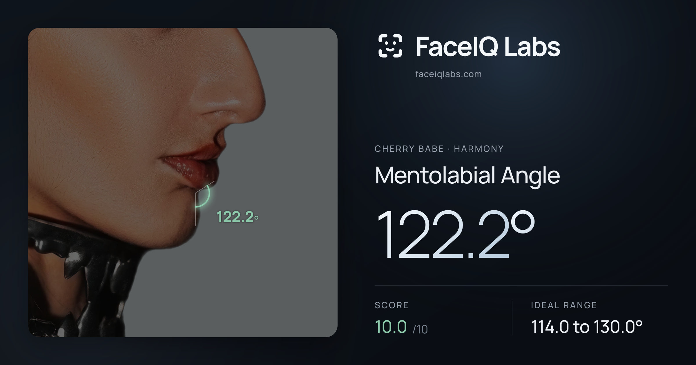 Cherry Babe Mentolabial Angle: 122.2°, drawn on the photo