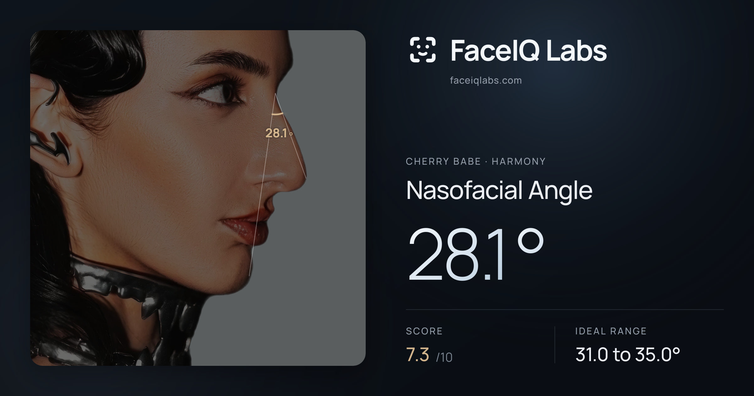 Cherry Babe Nasofacial Angle: 28.1°, drawn on the photo