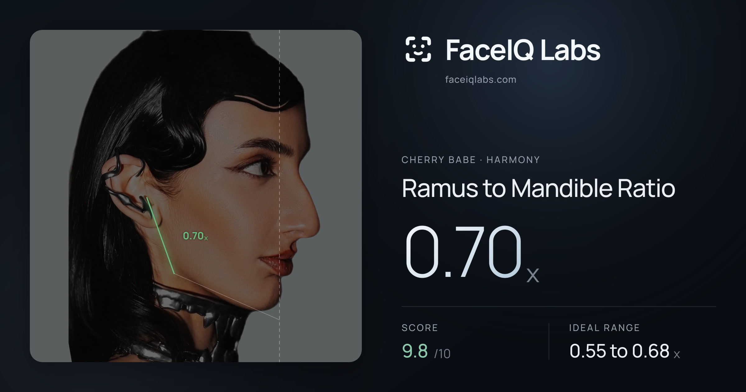 Cherry Babe Ramus to Mandible Ratio: 0.70x, drawn on the photo