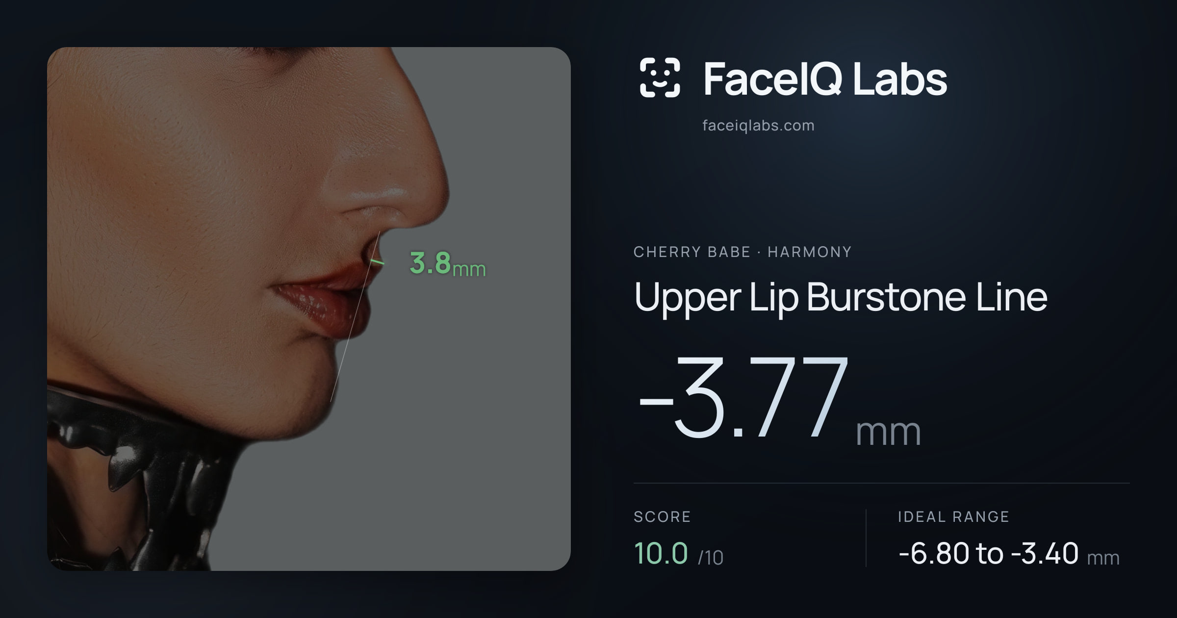 Cherry Babe Upper Lip Burstone Line: -3.77mm, drawn on the photo