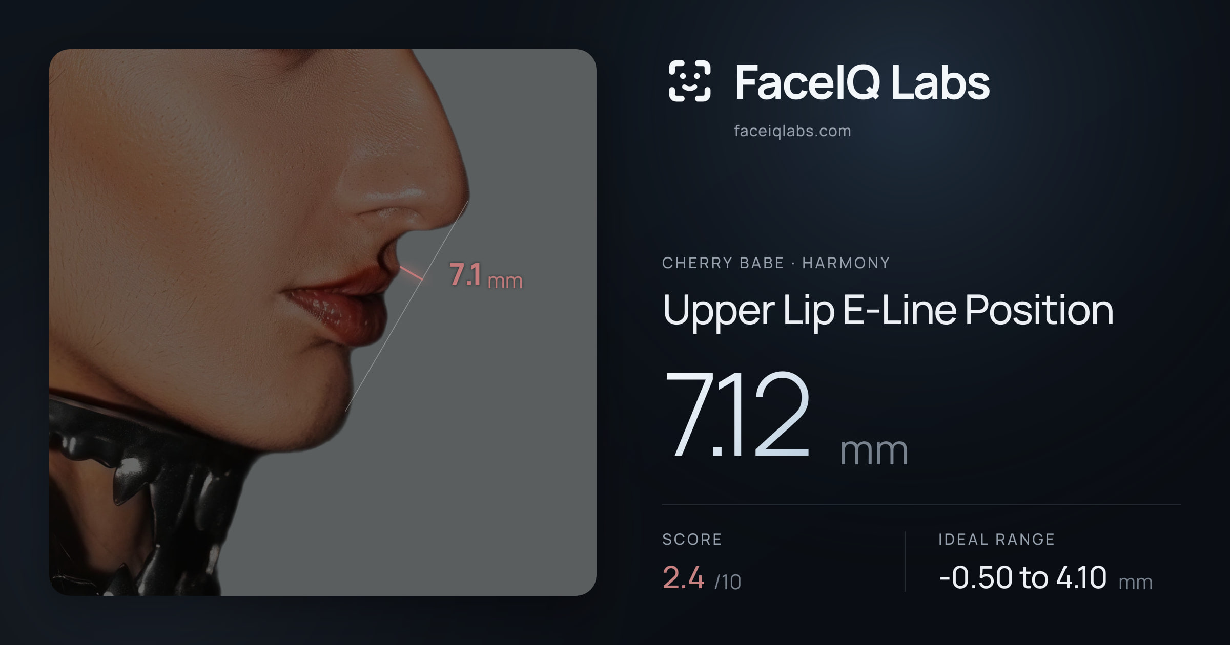 Cherry Babe Upper Lip E-Line Position: 7.12mm, drawn on the photo