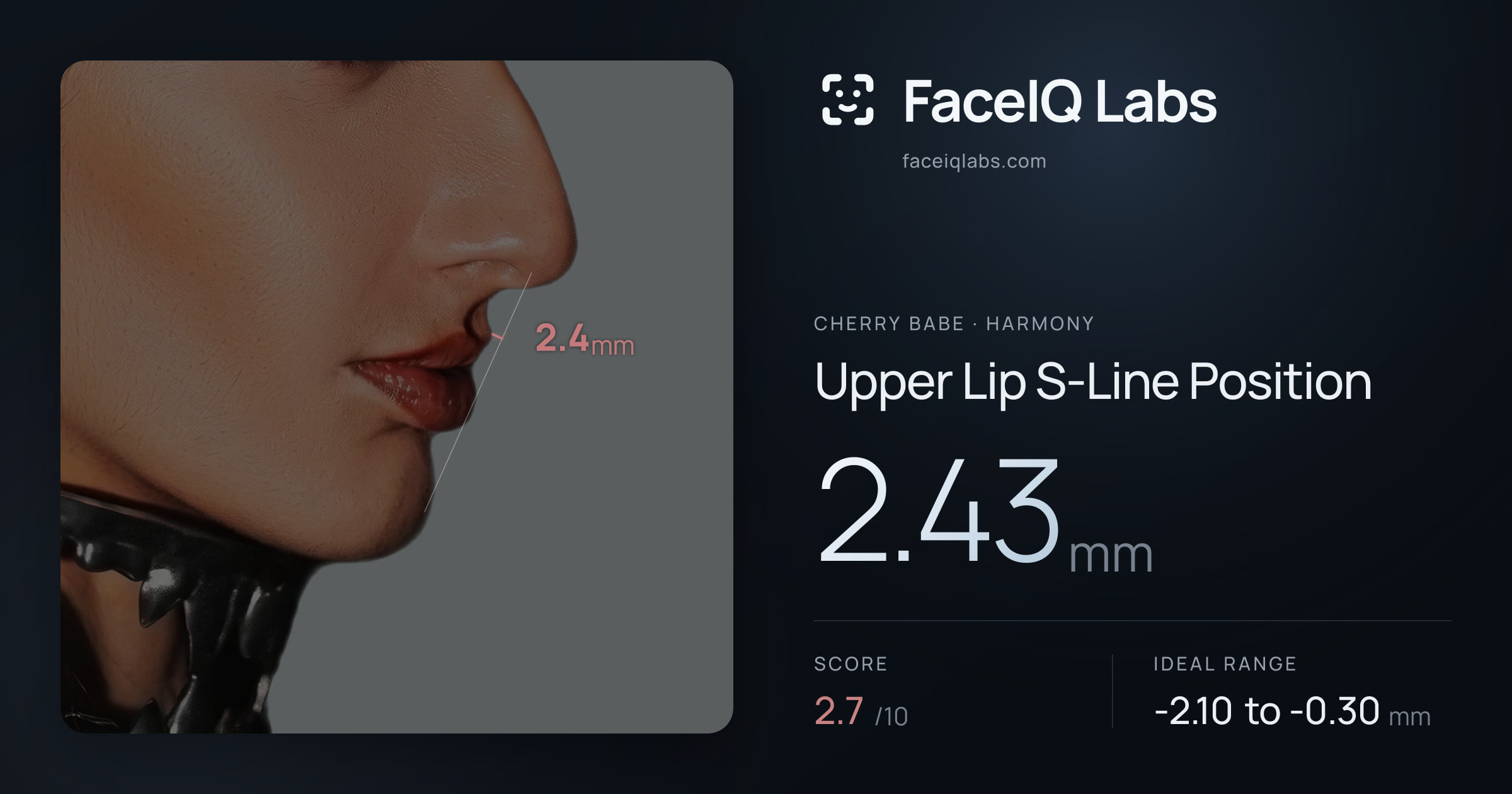 Cherry Babe Upper Lip S-Line Position: 2.43mm, drawn on the photo