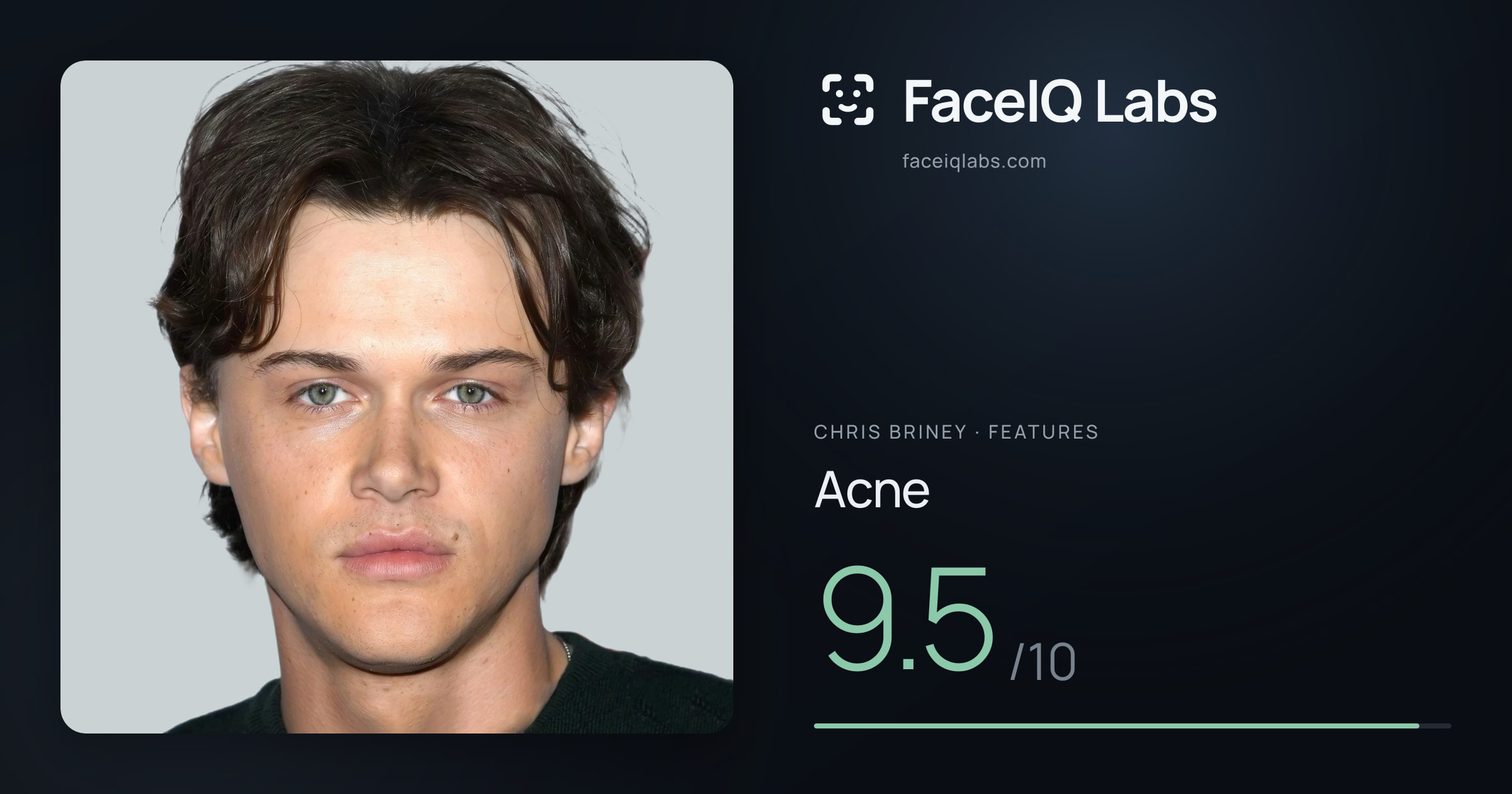 Chris Briney Acne: 9.5/10, drawn on the photo