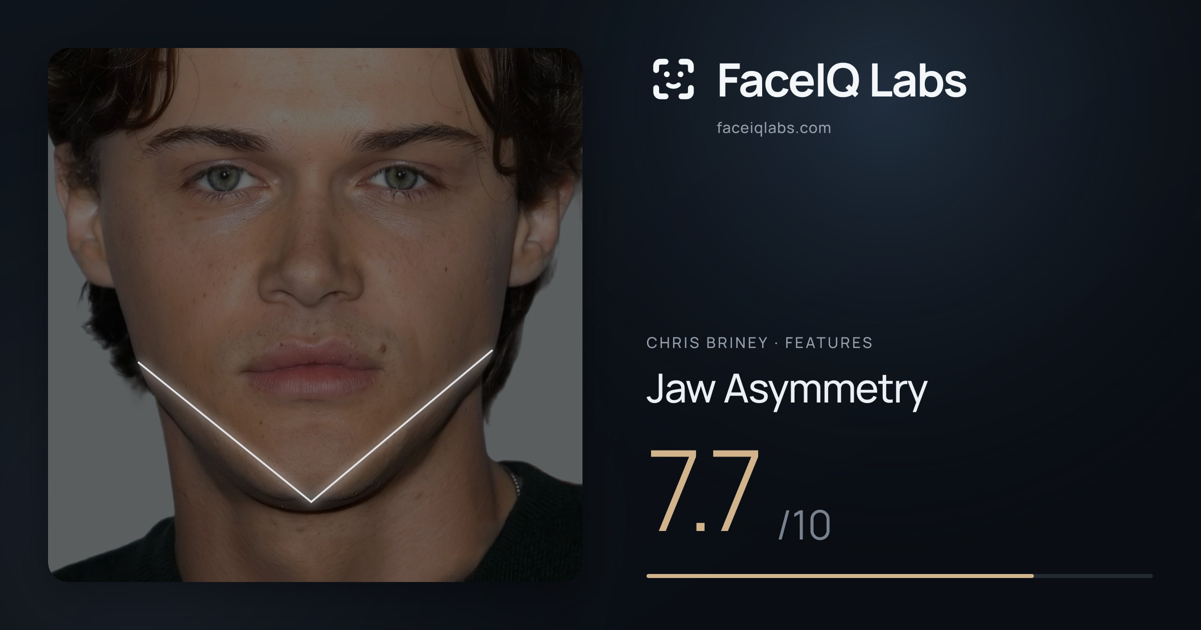 Chris Briney Jaw Asymmetry: 7.7/10, drawn on the photo