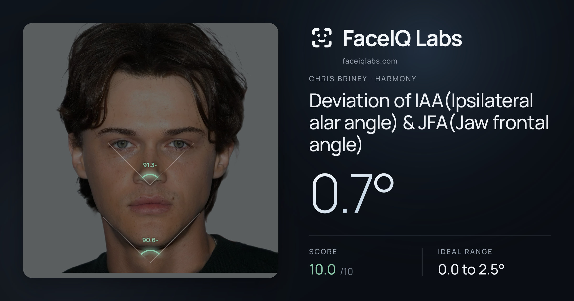 Chris Briney Deviation of IAA(Ipsilateral alar angle) & JFA(Jaw frontal angle): 0.7°, drawn on the photo