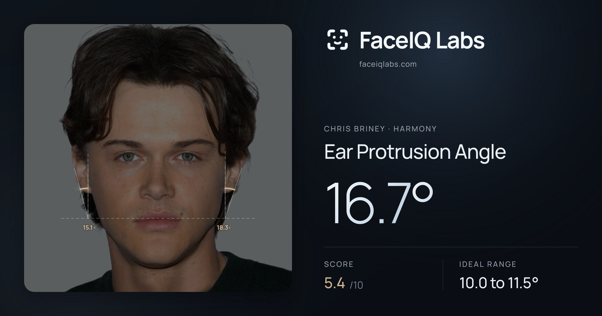 Chris Briney Ear Protrusion Angle: 16.7°, drawn on the photo