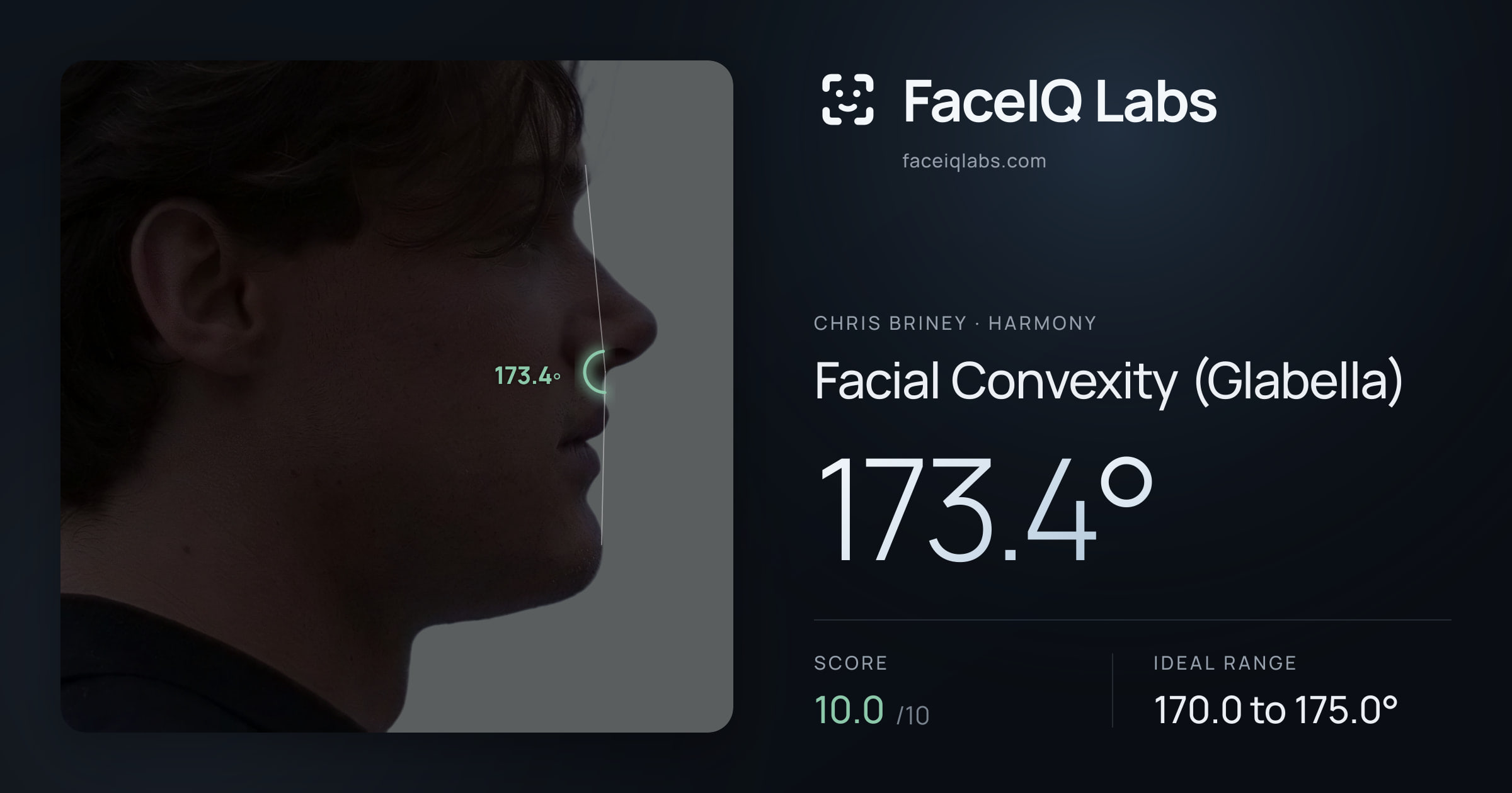 Chris Briney Facial Convexity (Glabella): 173.4°, drawn on the photo