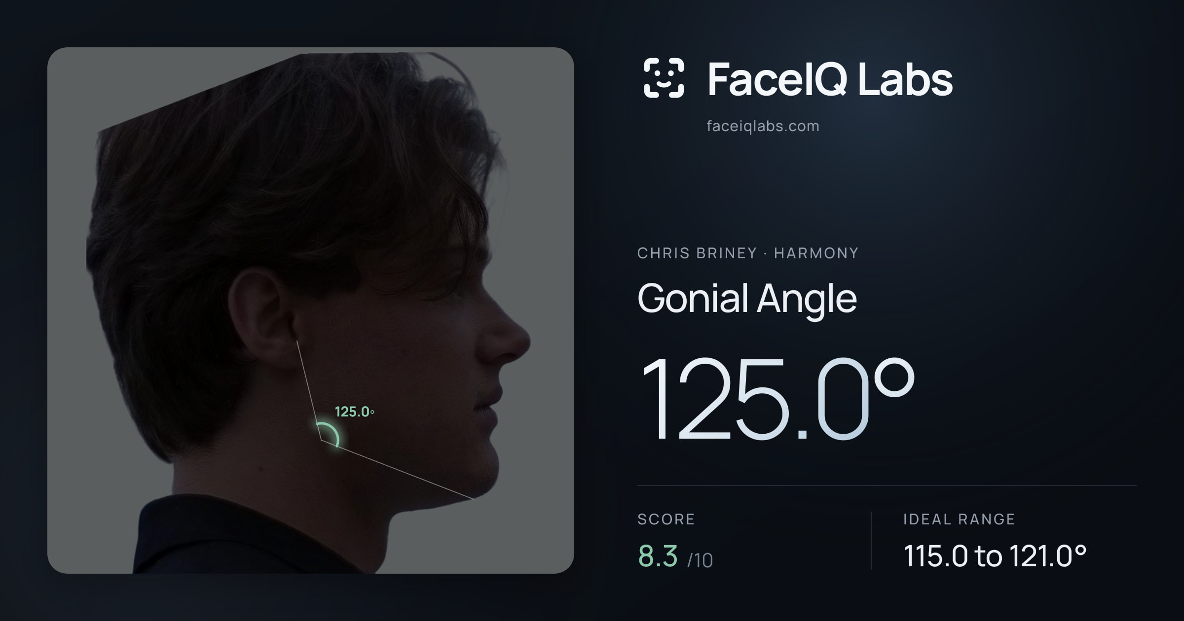 Chris Briney Gonial Angle: 125.0°, drawn on the photo