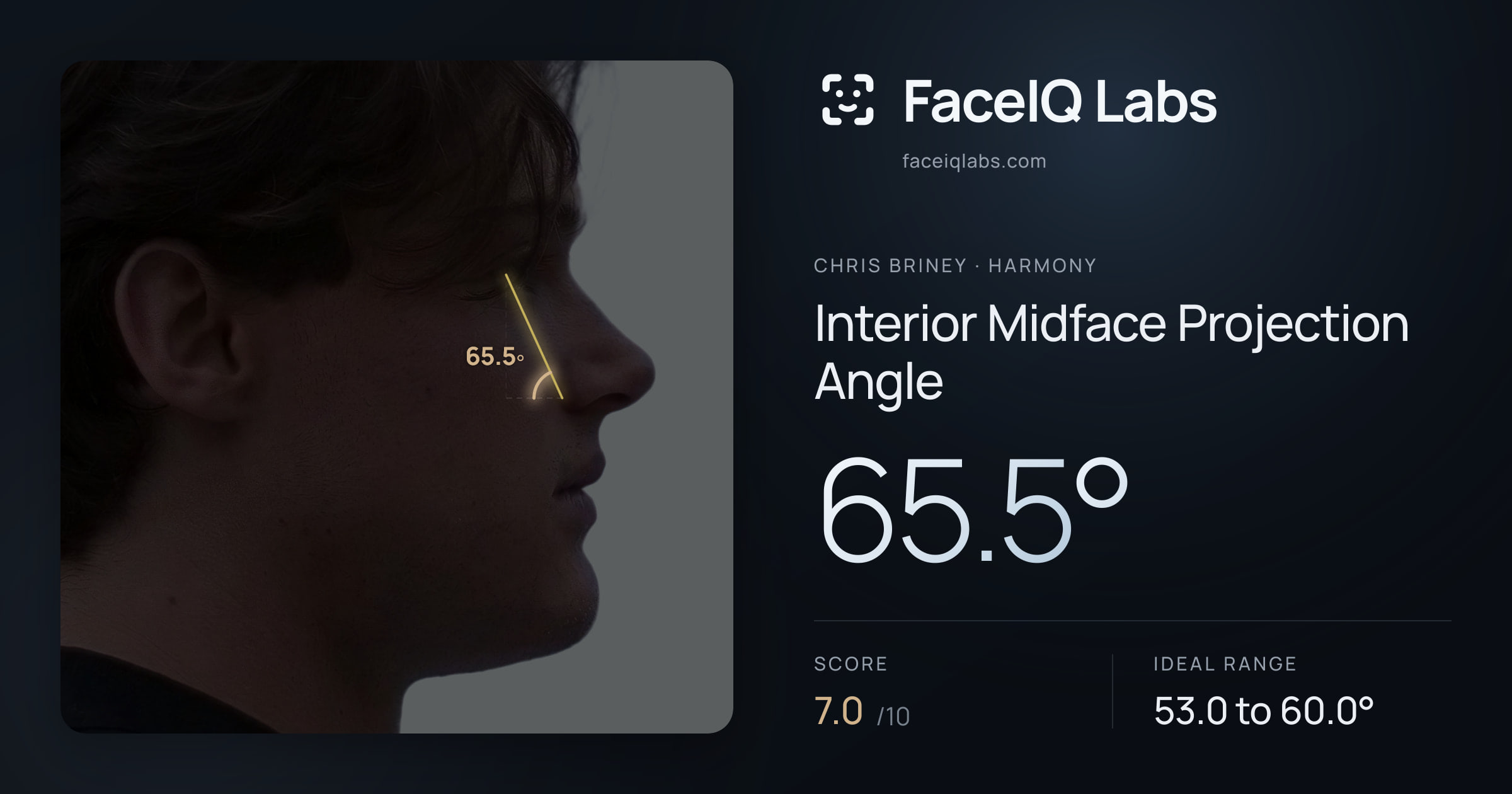 Chris Briney Interior Midface Projection Angle: 65.5°, drawn on the photo