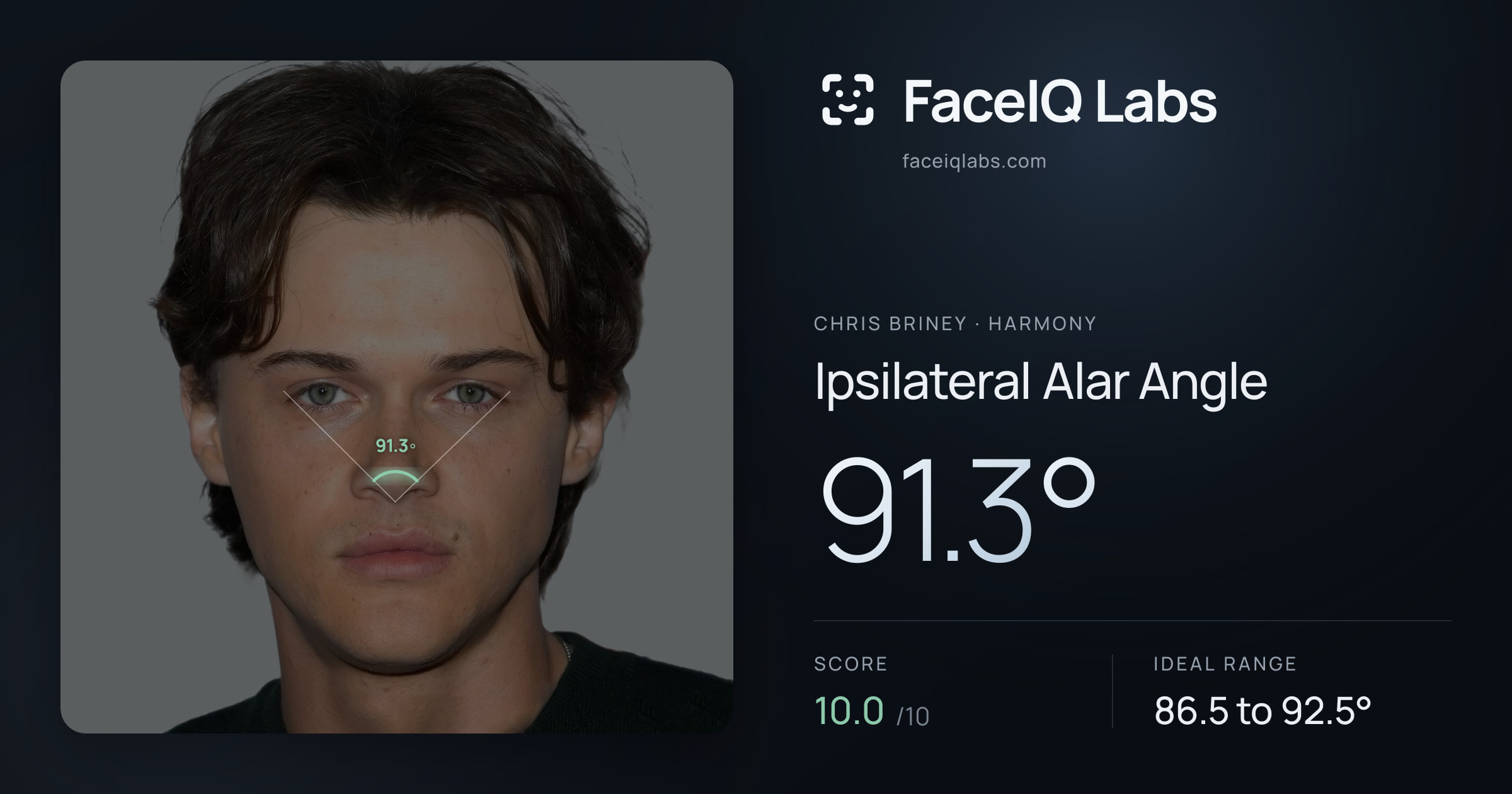 Chris Briney Ipsilateral Alar Angle: 91.3°, drawn on the photo