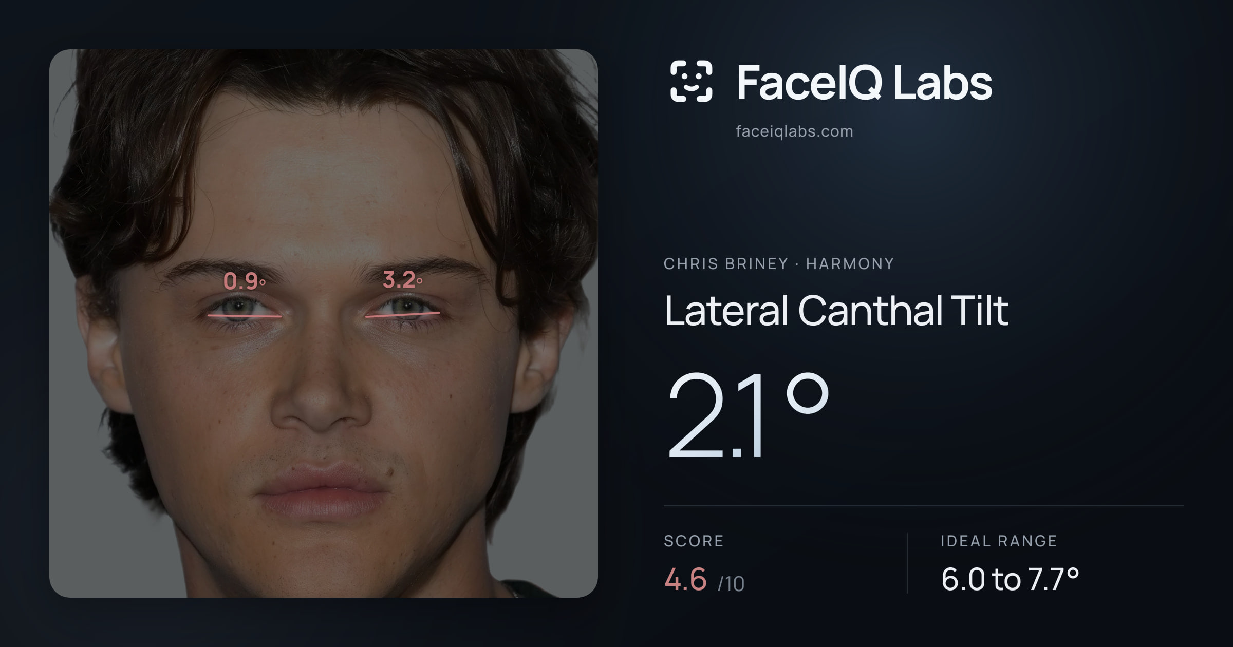 Chris Briney Lateral Canthal Tilt: 2.1°, drawn on the photo