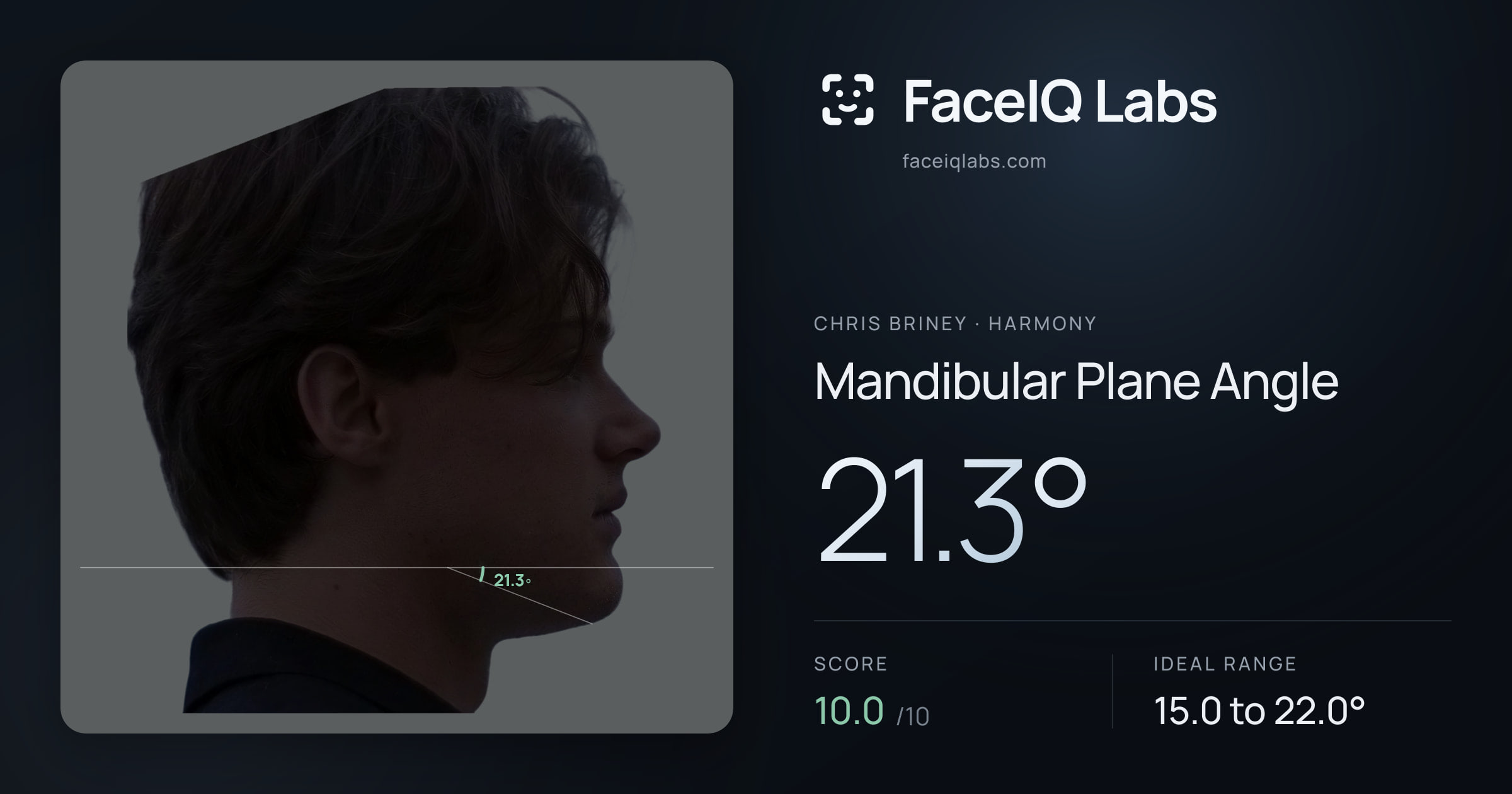 Chris Briney Mandibular Plane Angle: 21.3°, drawn on the photo