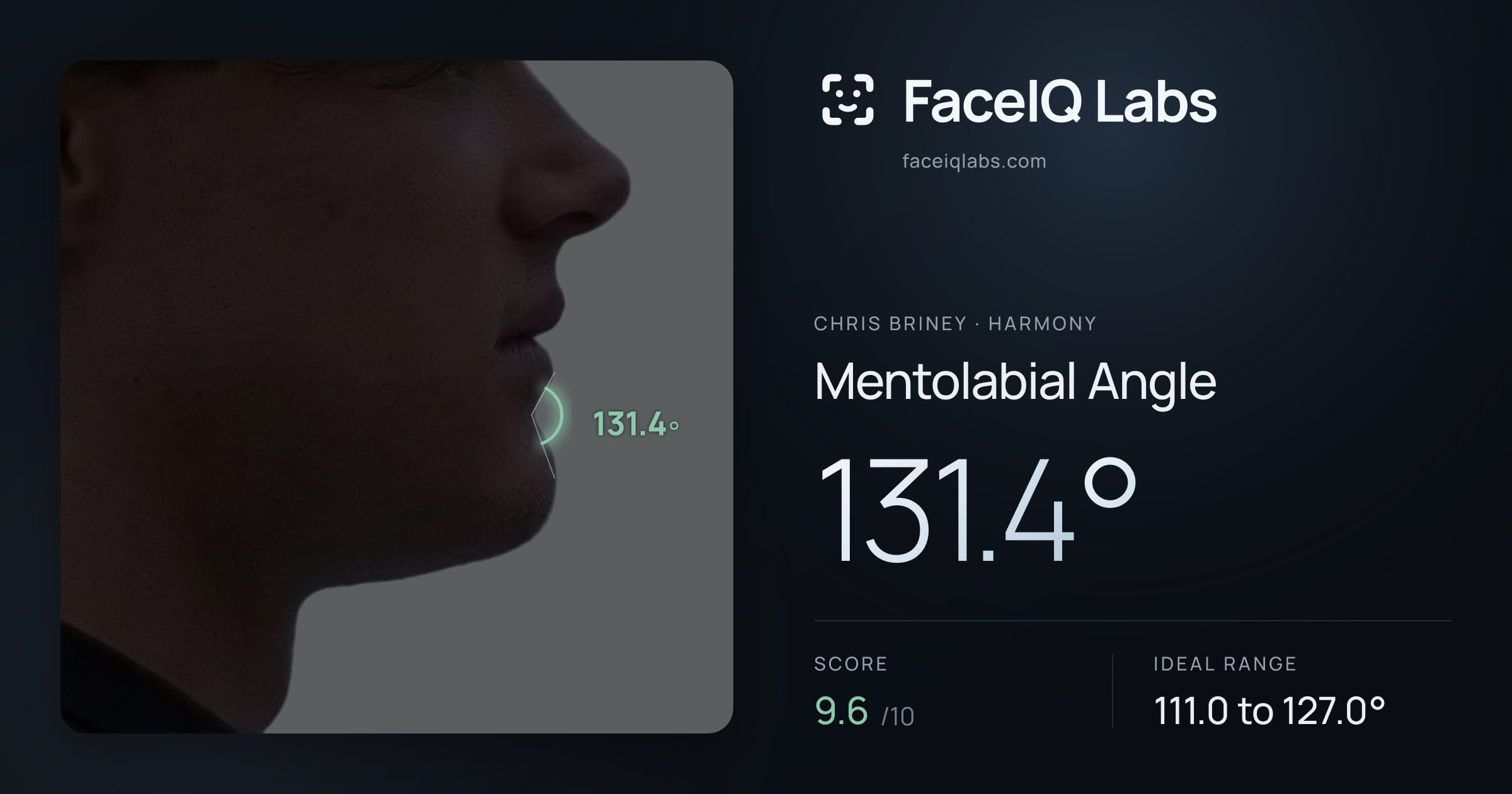 Chris Briney Mentolabial Angle: 131.4°, drawn on the photo