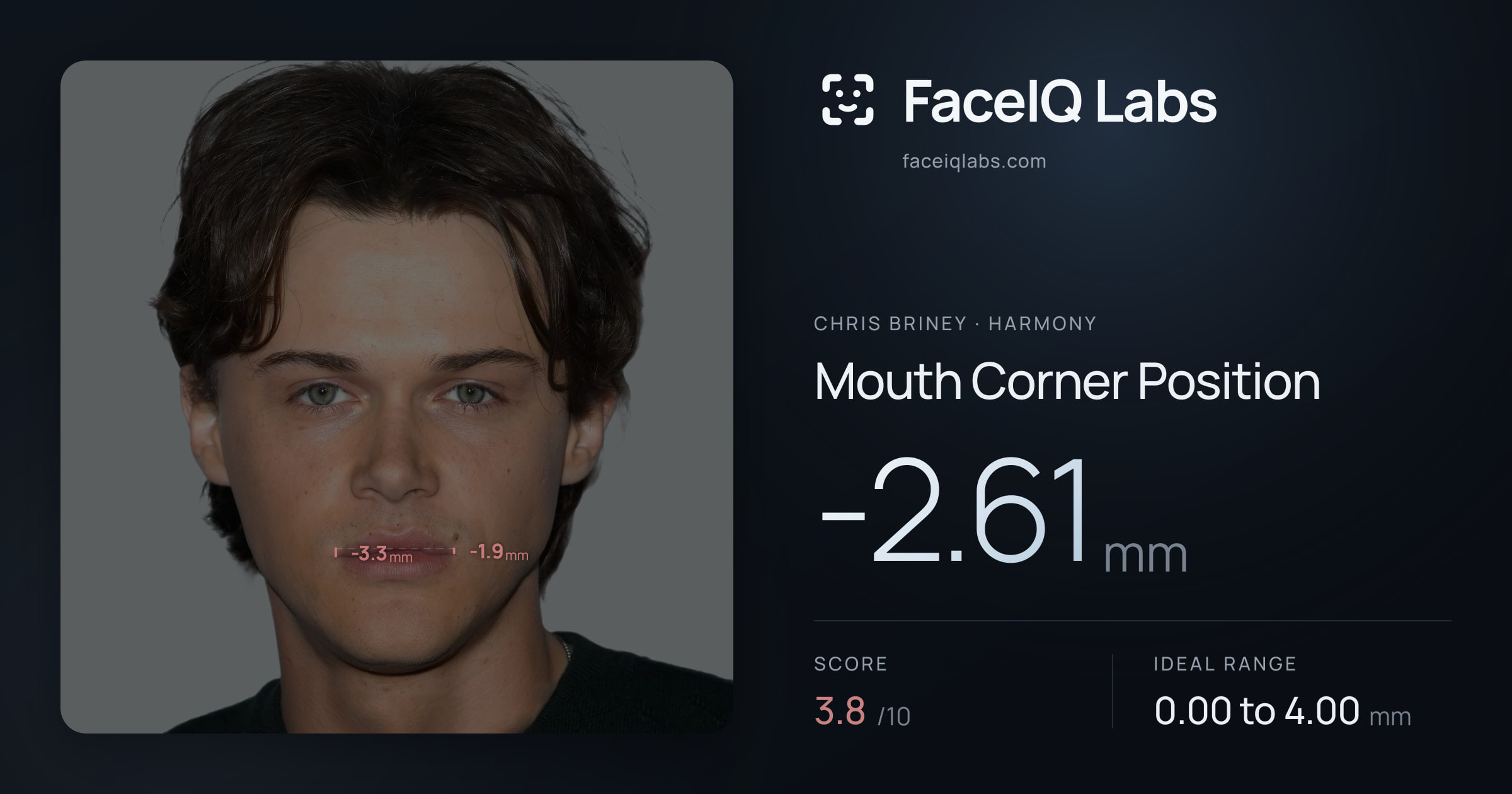 Chris Briney Mouth Corner Position: -2.61mm, drawn on the photo
