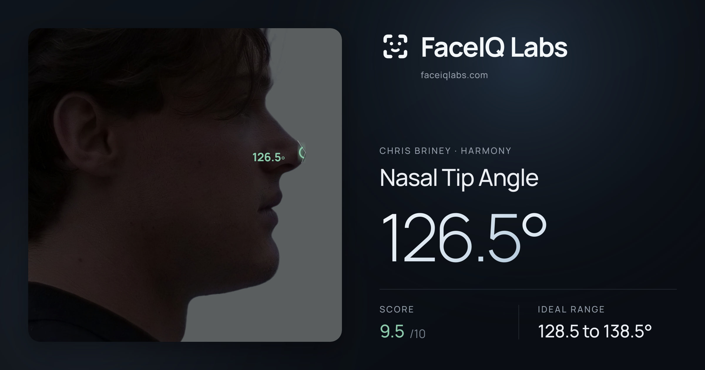 Chris Briney Nasal Tip Angle: 126.5°, drawn on the photo
