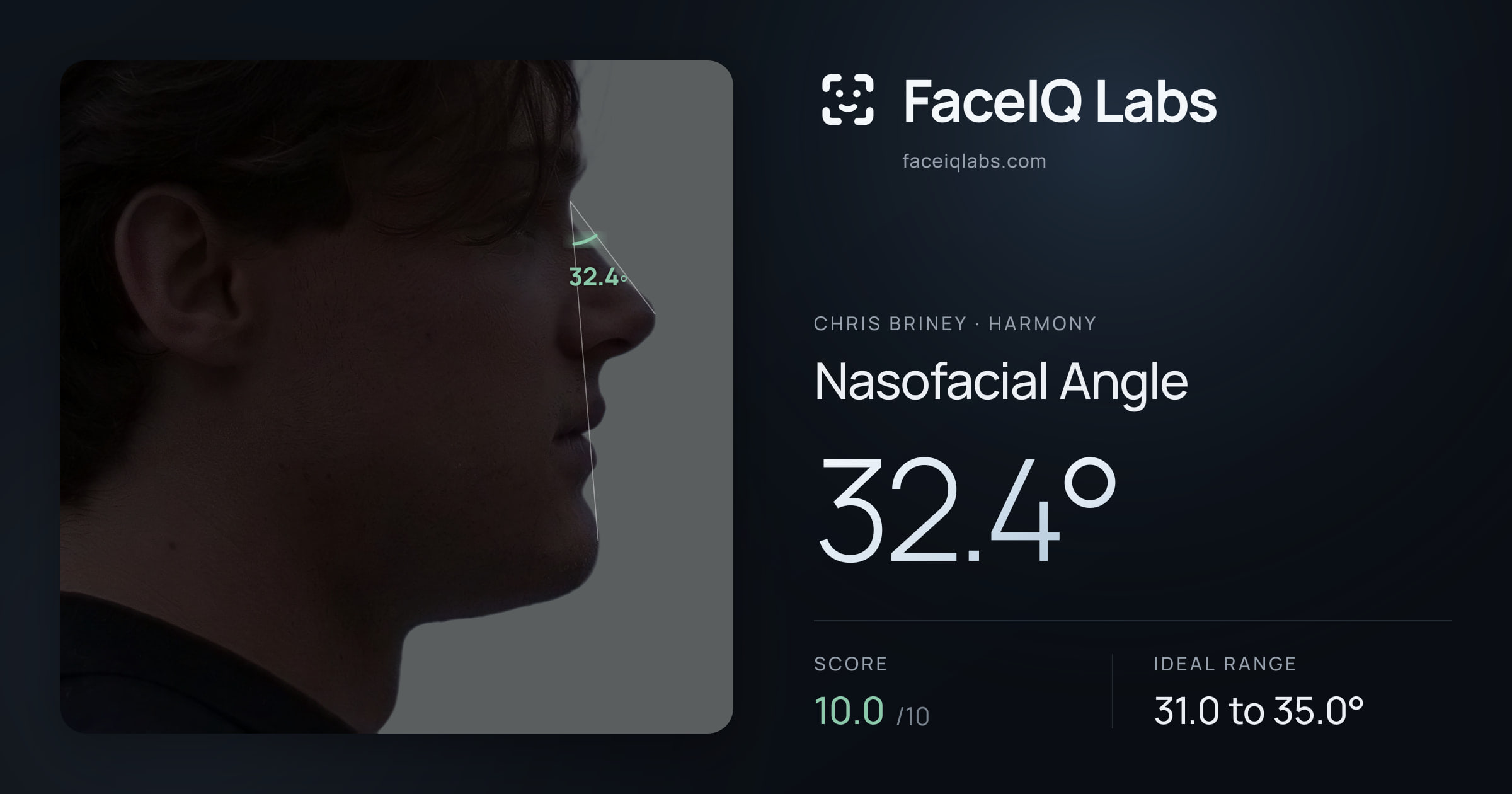 Chris Briney Nasofacial Angle: 32.4°, drawn on the photo