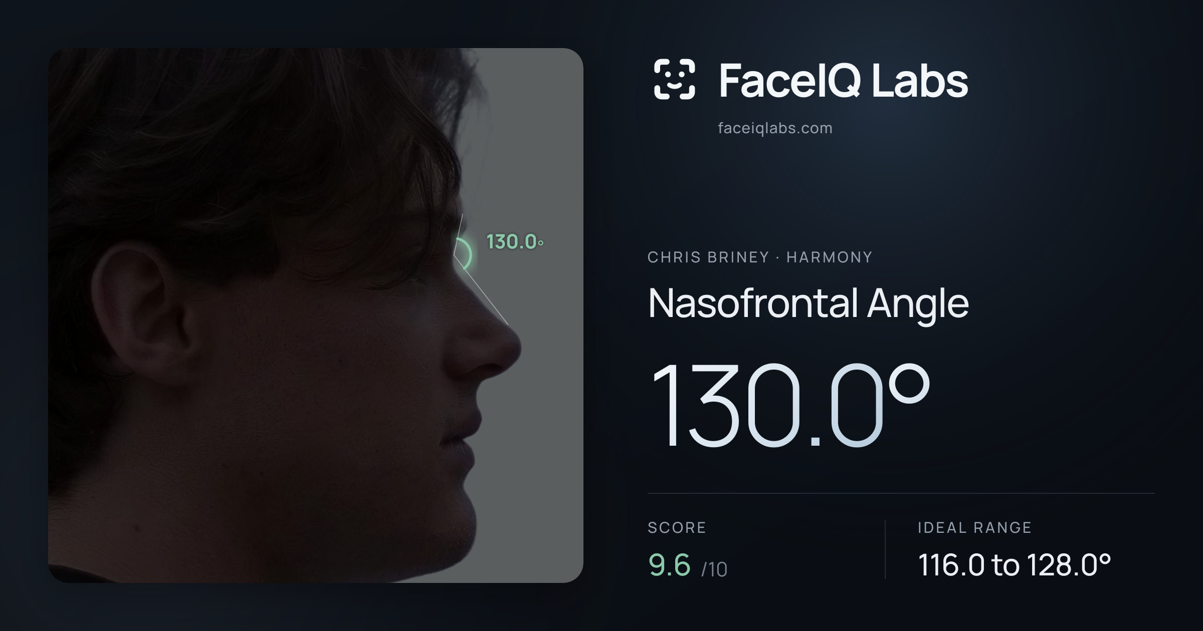 Chris Briney Nasofrontal Angle: 130.0°, drawn on the photo