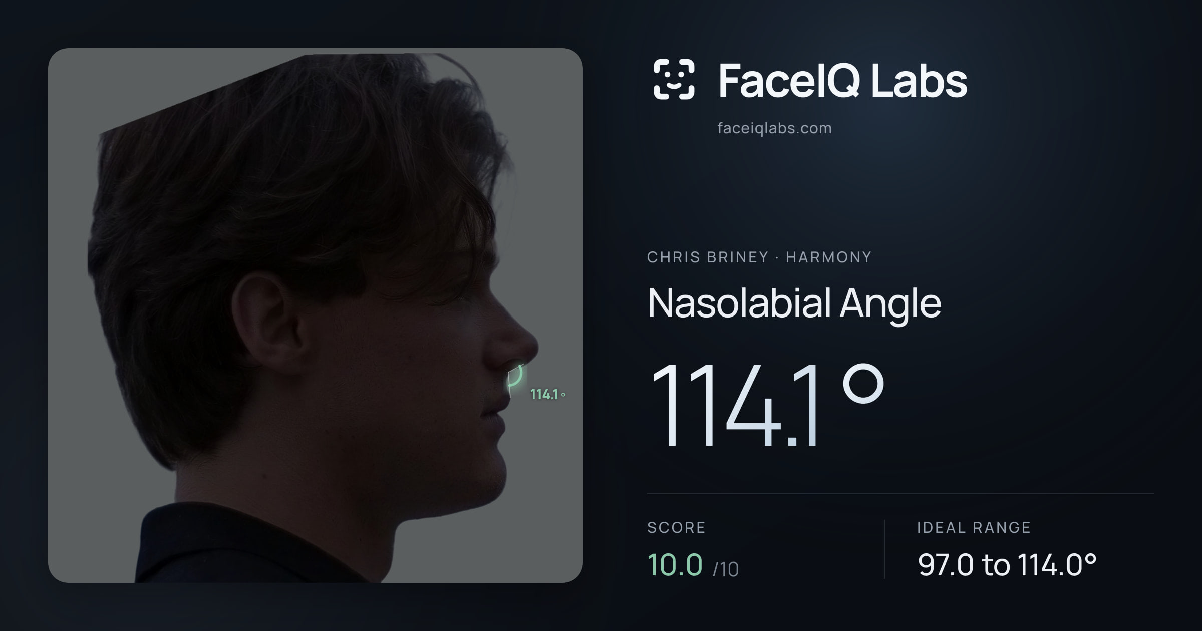 Chris Briney Nasolabial Angle: 114.1°, drawn on the photo