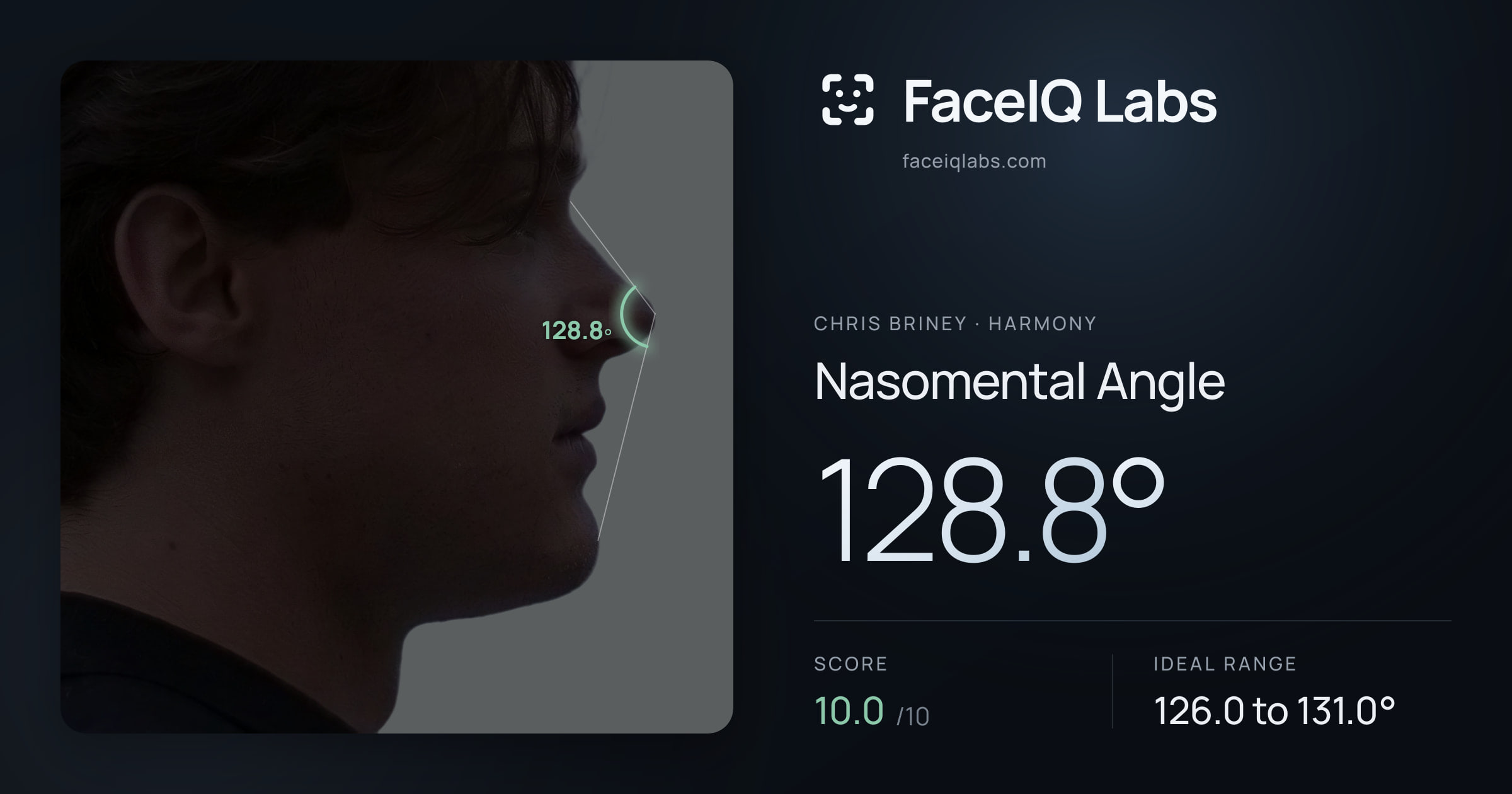 Chris Briney Nasomental Angle: 128.8°, drawn on the photo