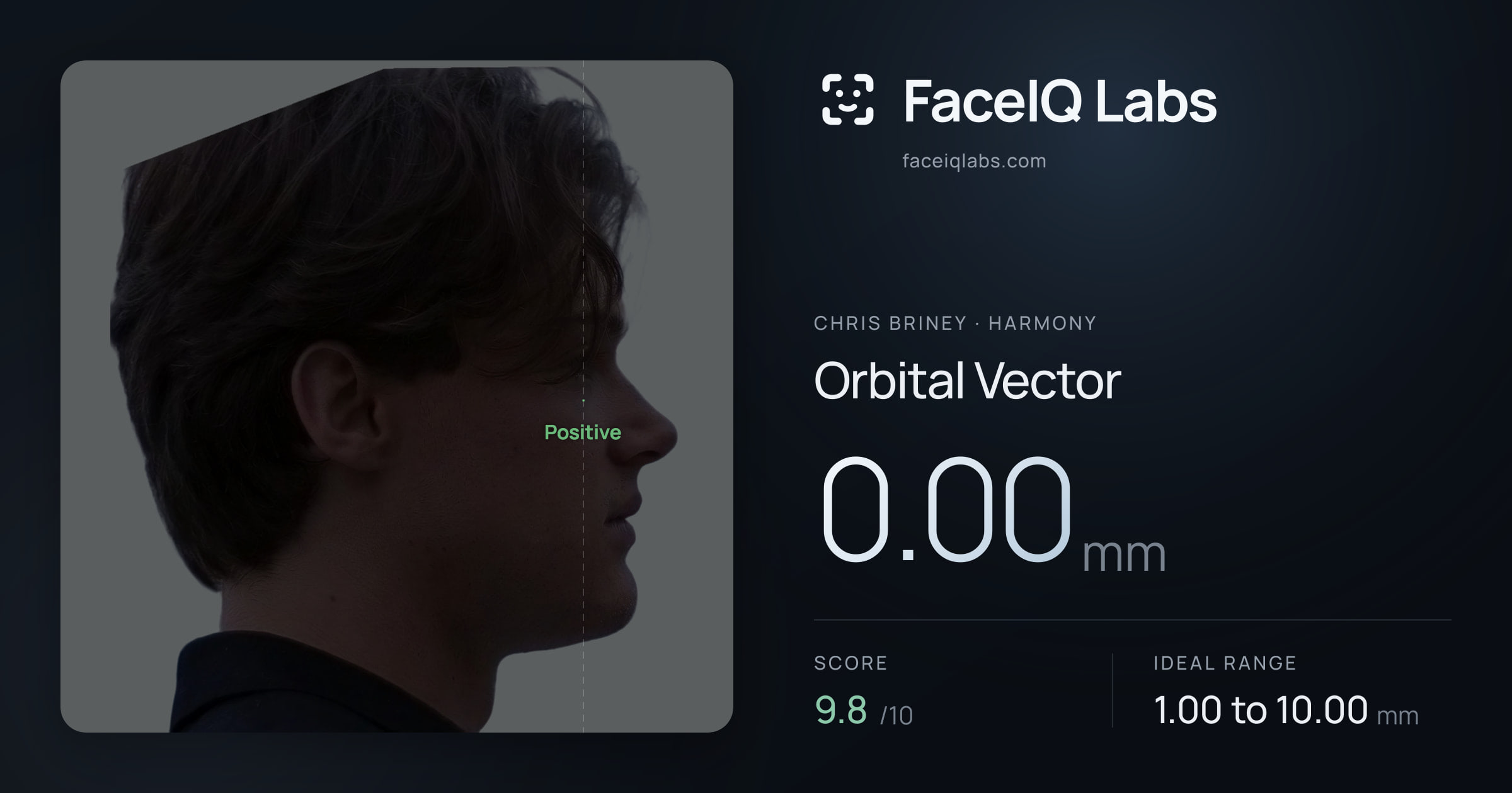 Chris Briney Orbital Vector: 0.00mm, drawn on the photo