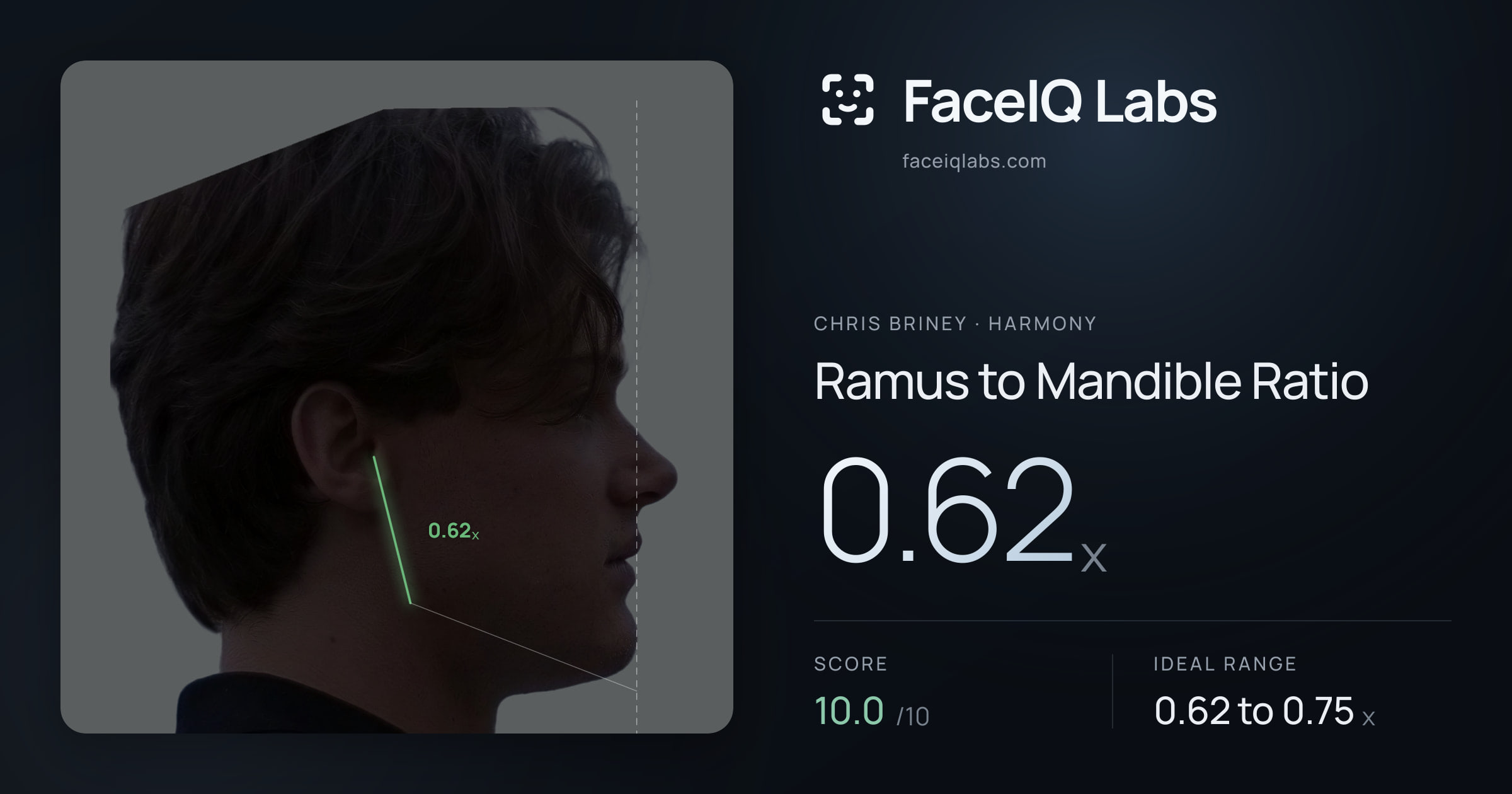 Chris Briney Ramus to Mandible Ratio: 0.62x, drawn on the photo