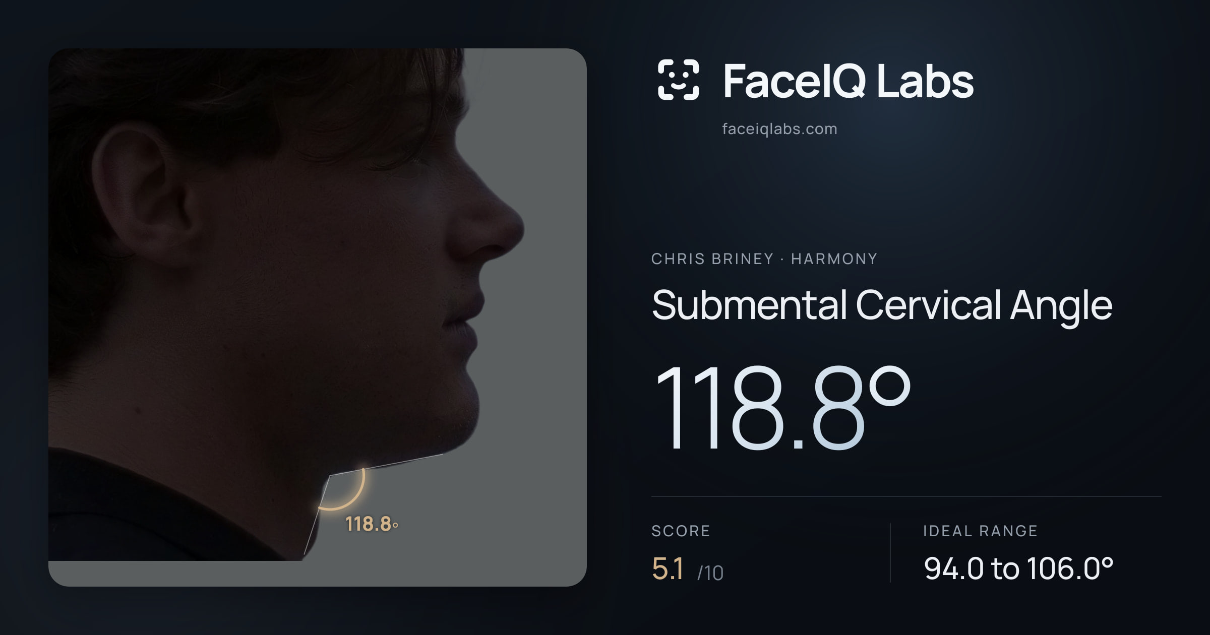 Chris Briney Submental Cervical Angle: 118.8°, drawn on the photo