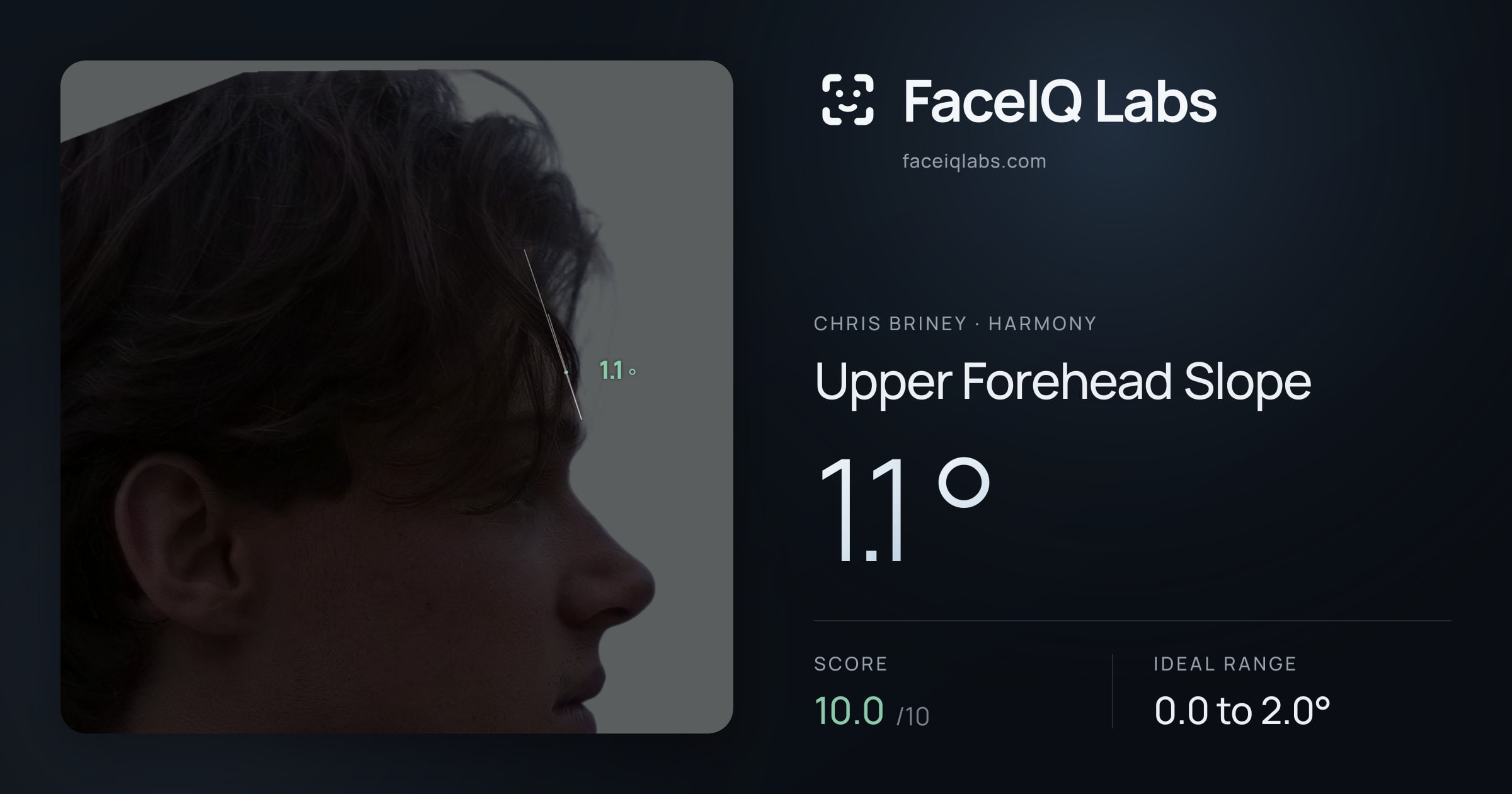 Chris Briney Upper Forehead Slope: 1.1°, drawn on the photo