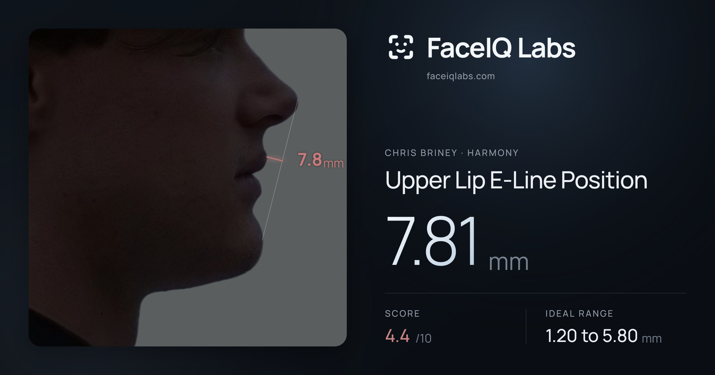 Chris Briney Upper Lip E-Line Position: 7.81mm, drawn on the photo