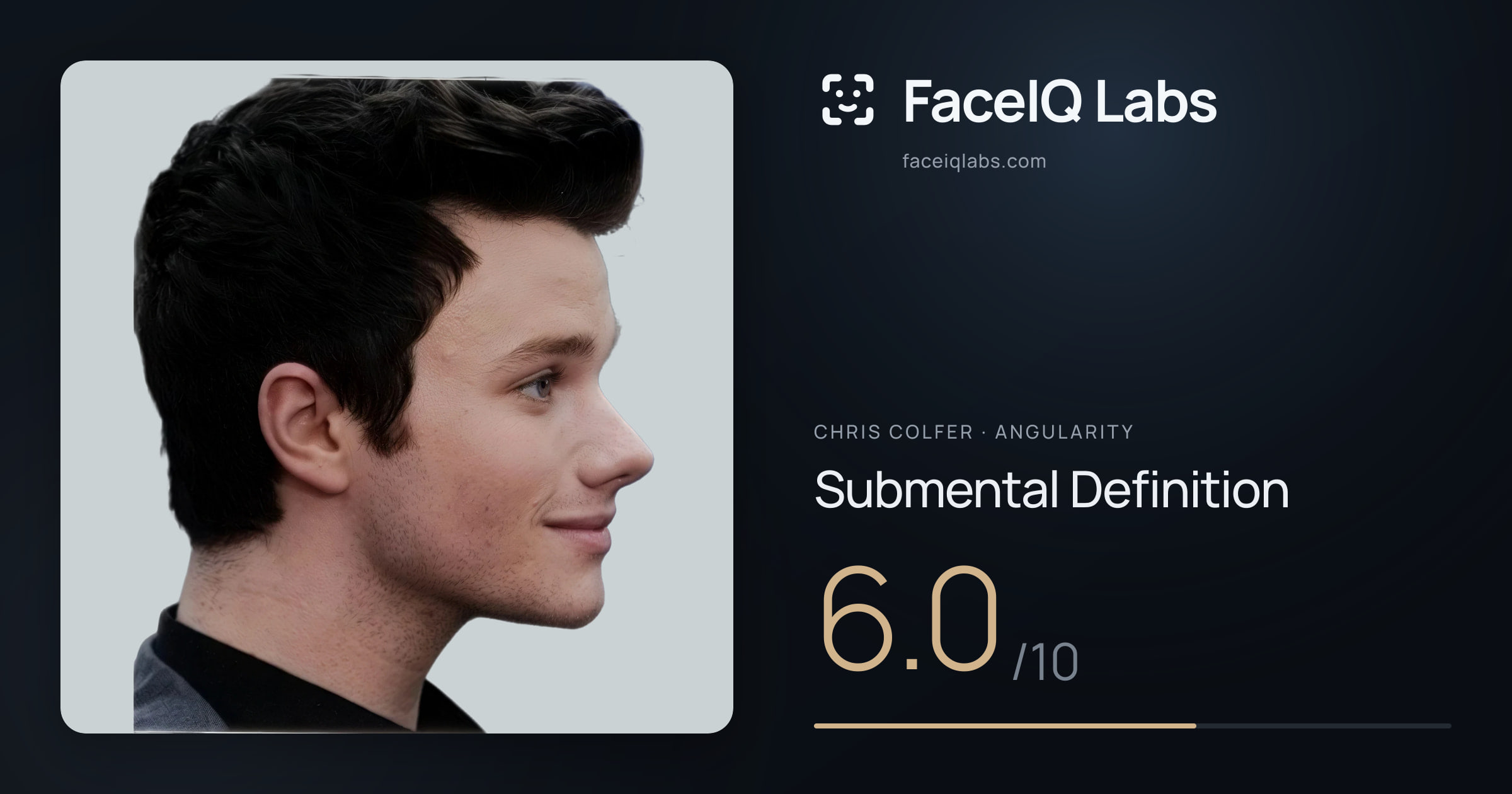 Chris Colfer Submental Definition: 6.0/10, drawn on the photo