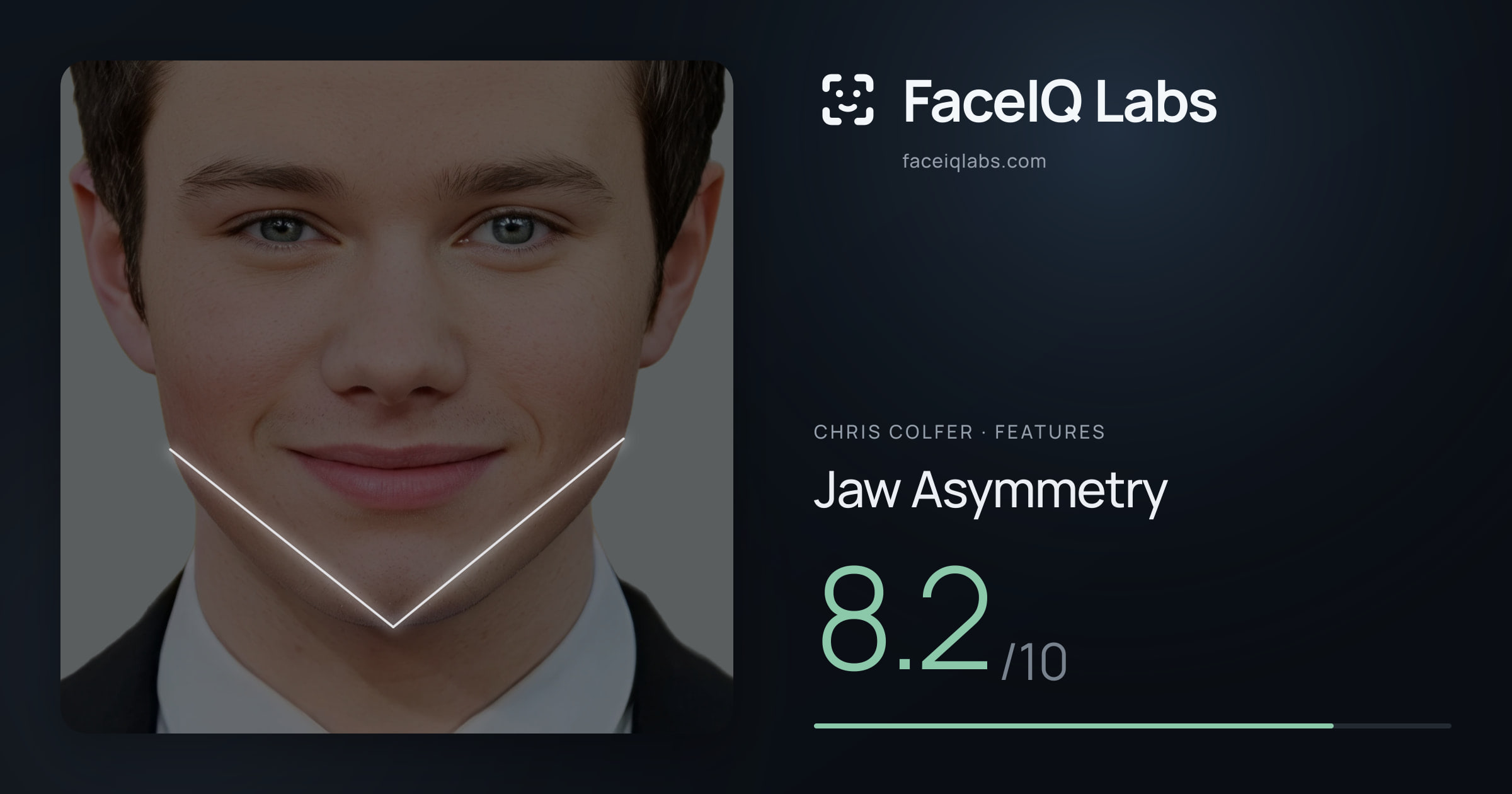 Chris Colfer Jaw Asymmetry: 8.2/10, drawn on the photo