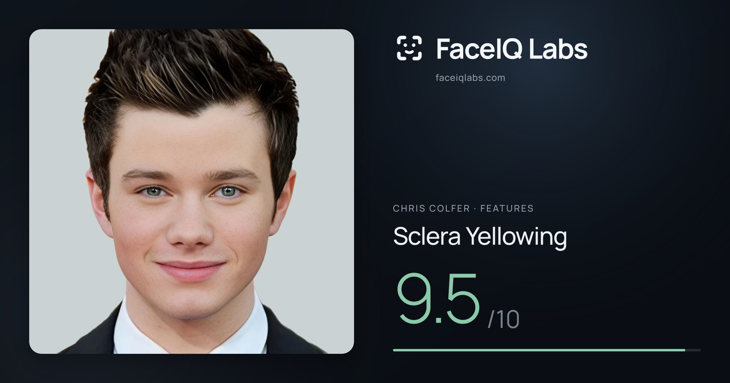 Chris Colfer Sclera Yellowing: 9.5/10, drawn on the photo