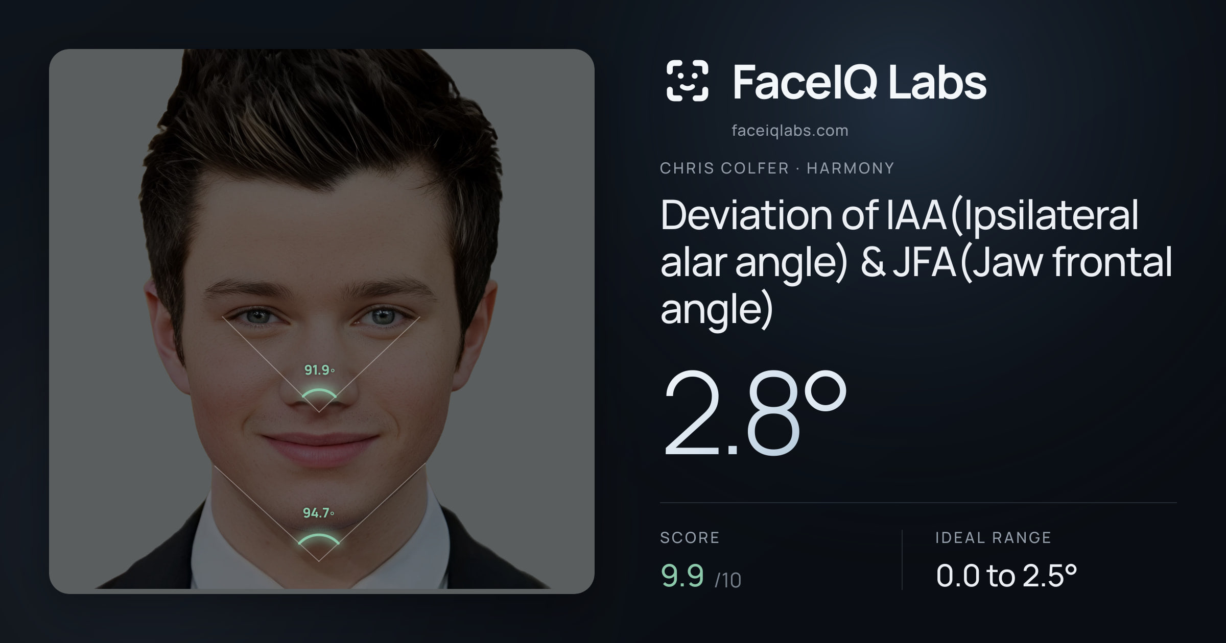 Chris Colfer Deviation of IAA(Ipsilateral alar angle) & JFA(Jaw frontal angle): 2.8°, drawn on the photo