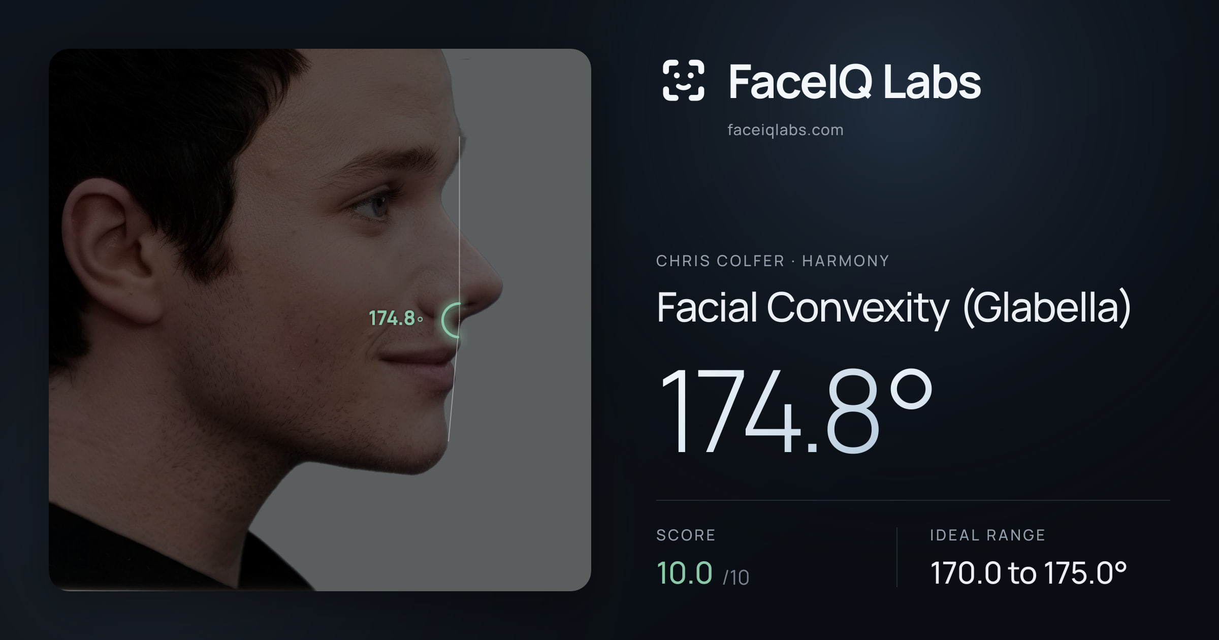 Chris Colfer Facial Convexity (Glabella): 174.8°, drawn on the photo