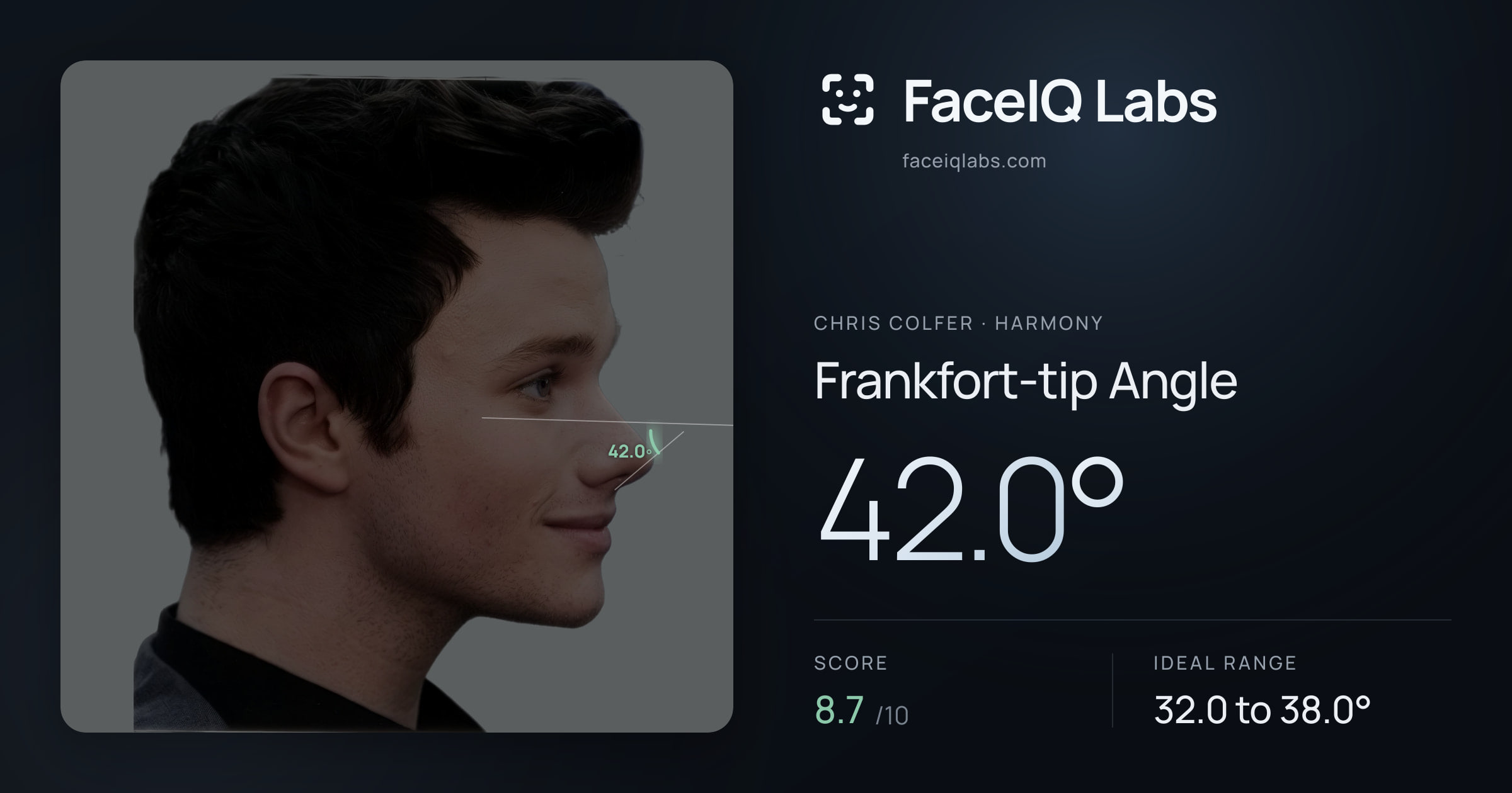 Chris Colfer Frankfort-tip Angle: 42.0°, drawn on the photo
