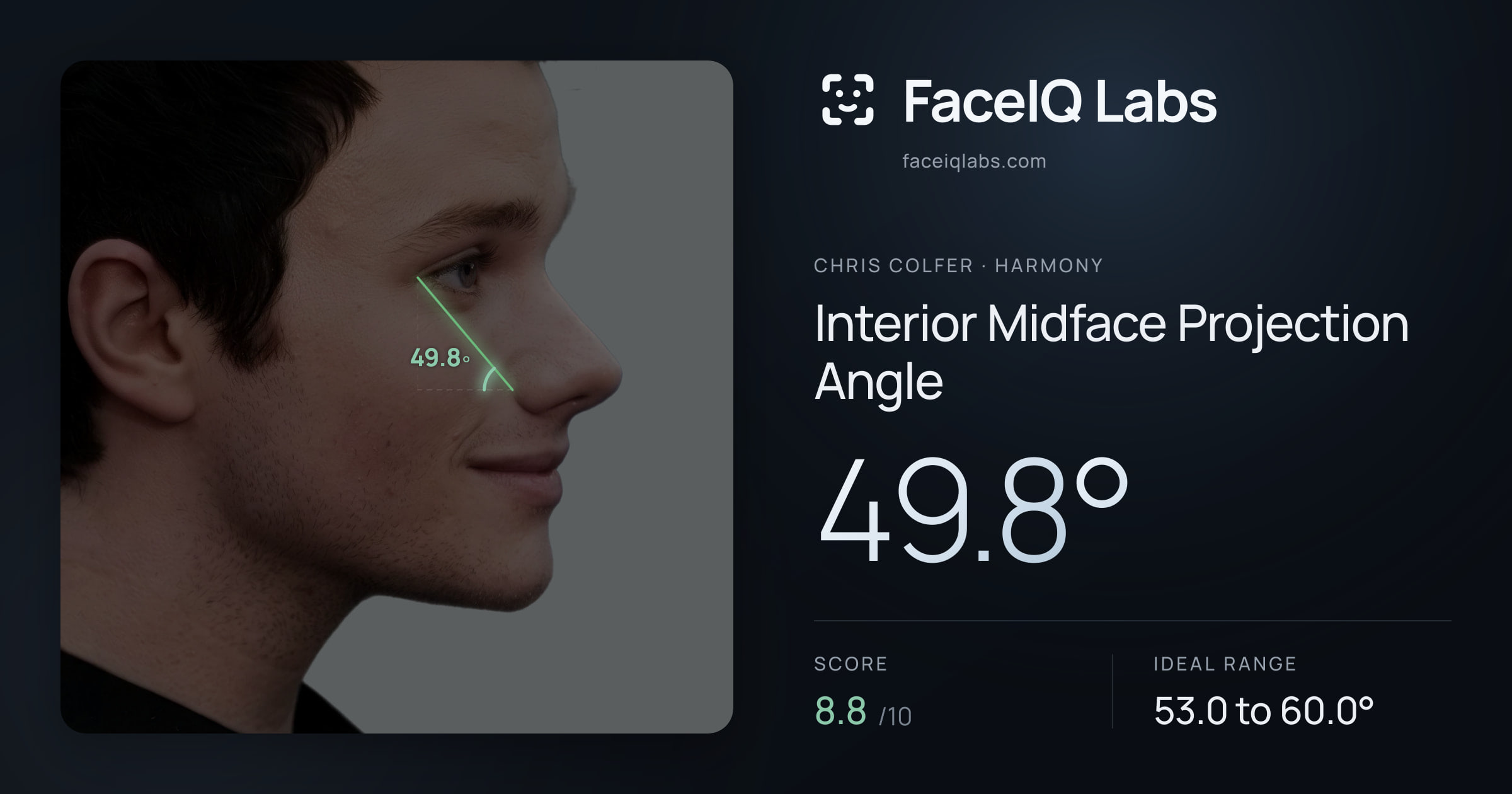 Chris Colfer Interior Midface Projection Angle: 49.8°, drawn on the photo