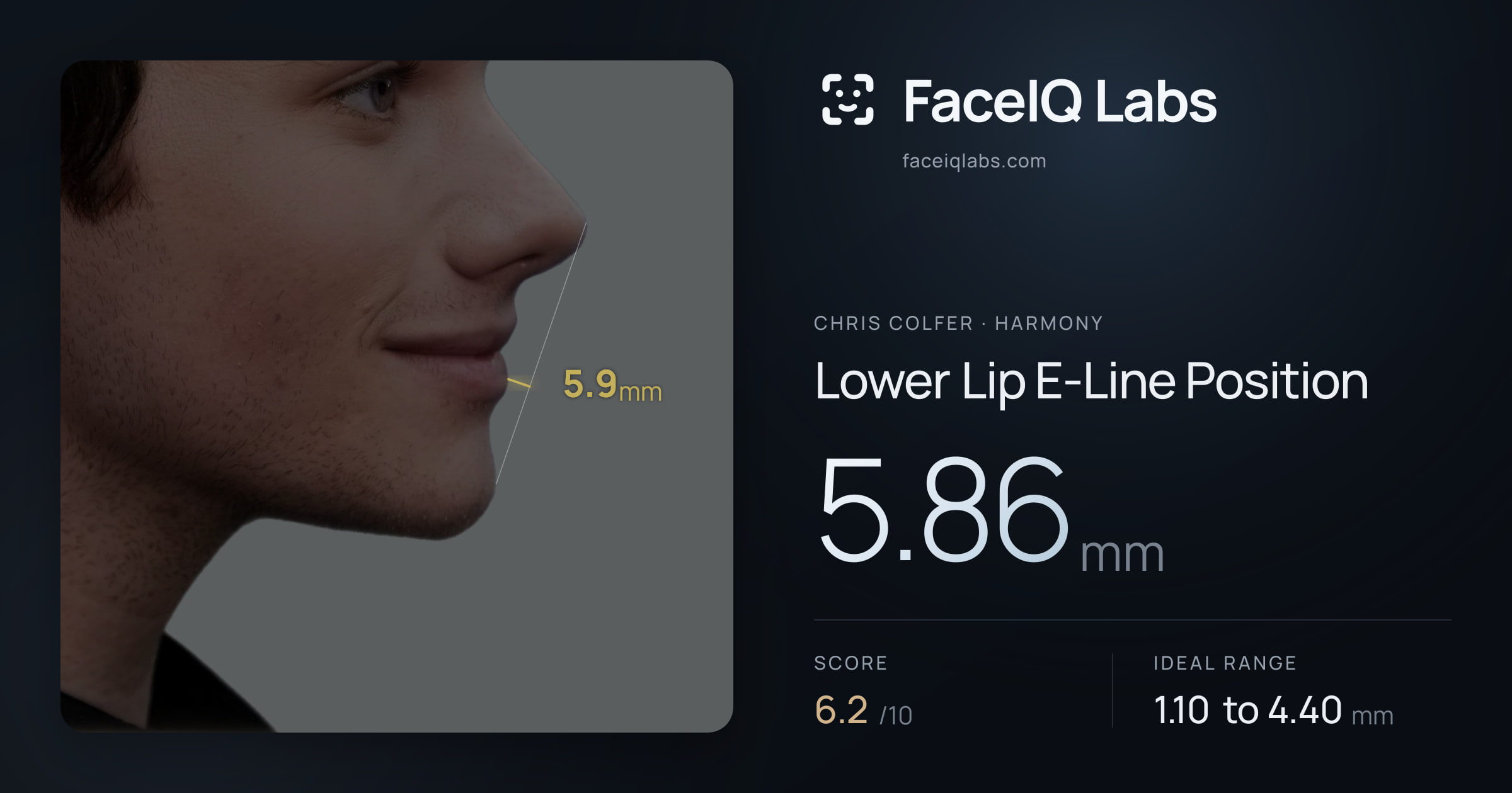 Chris Colfer Lower Lip E-Line Position: 5.86mm, drawn on the photo