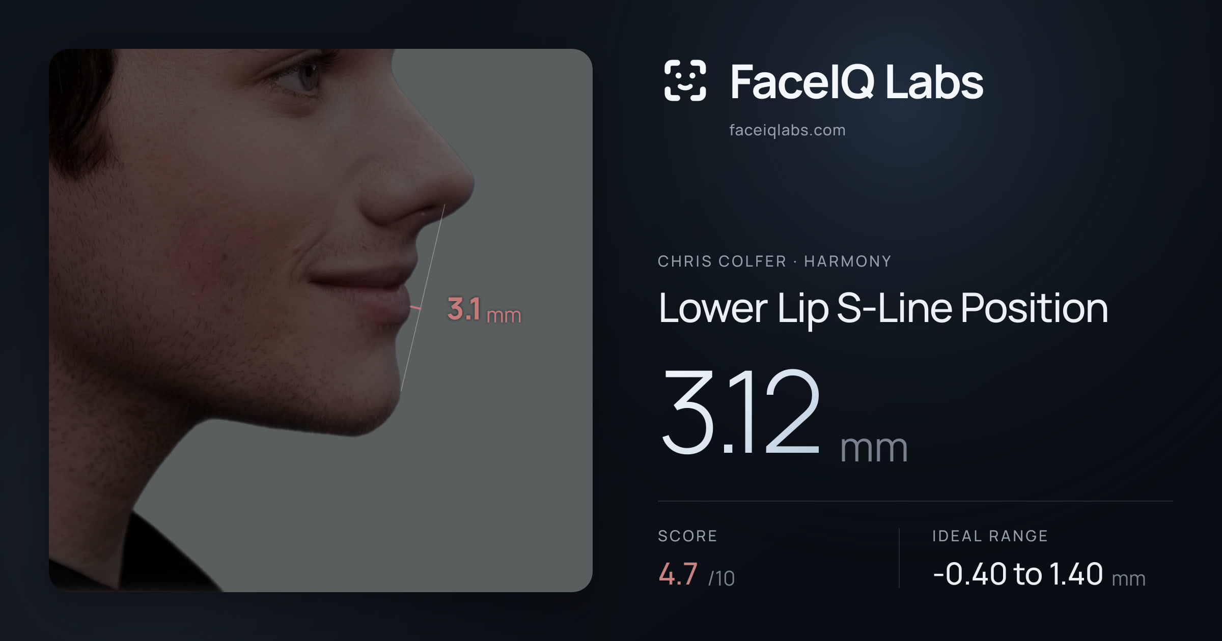 Chris Colfer Lower Lip S-Line Position: 3.12mm, drawn on the photo
