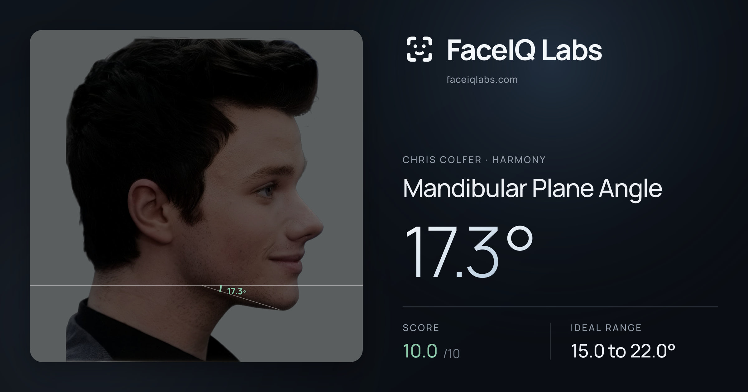 Chris Colfer Mandibular Plane Angle: 17.3°, drawn on the photo