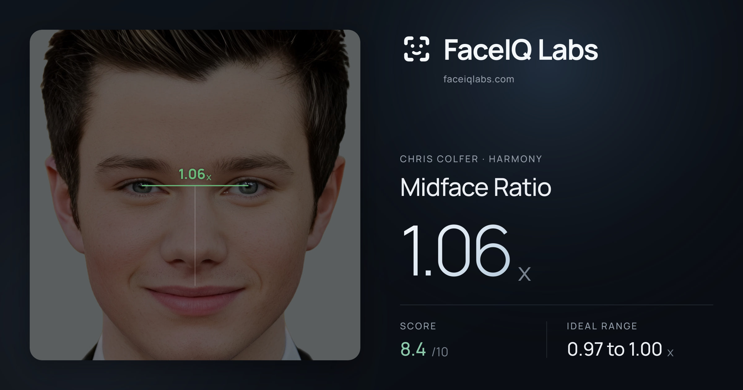 Chris Colfer Midface Ratio: 1.06x, drawn on the photo