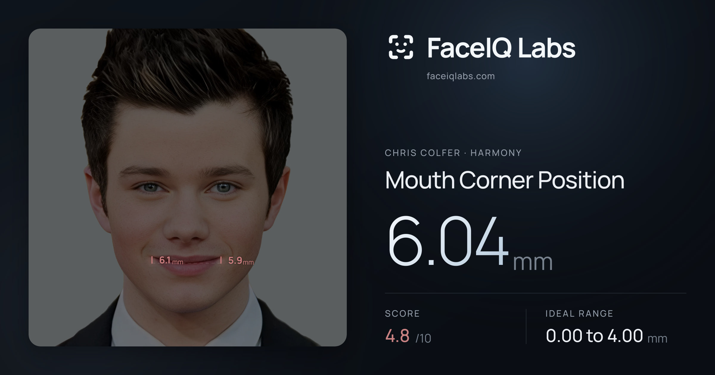 Chris Colfer Mouth Corner Position: 6.04mm, drawn on the photo