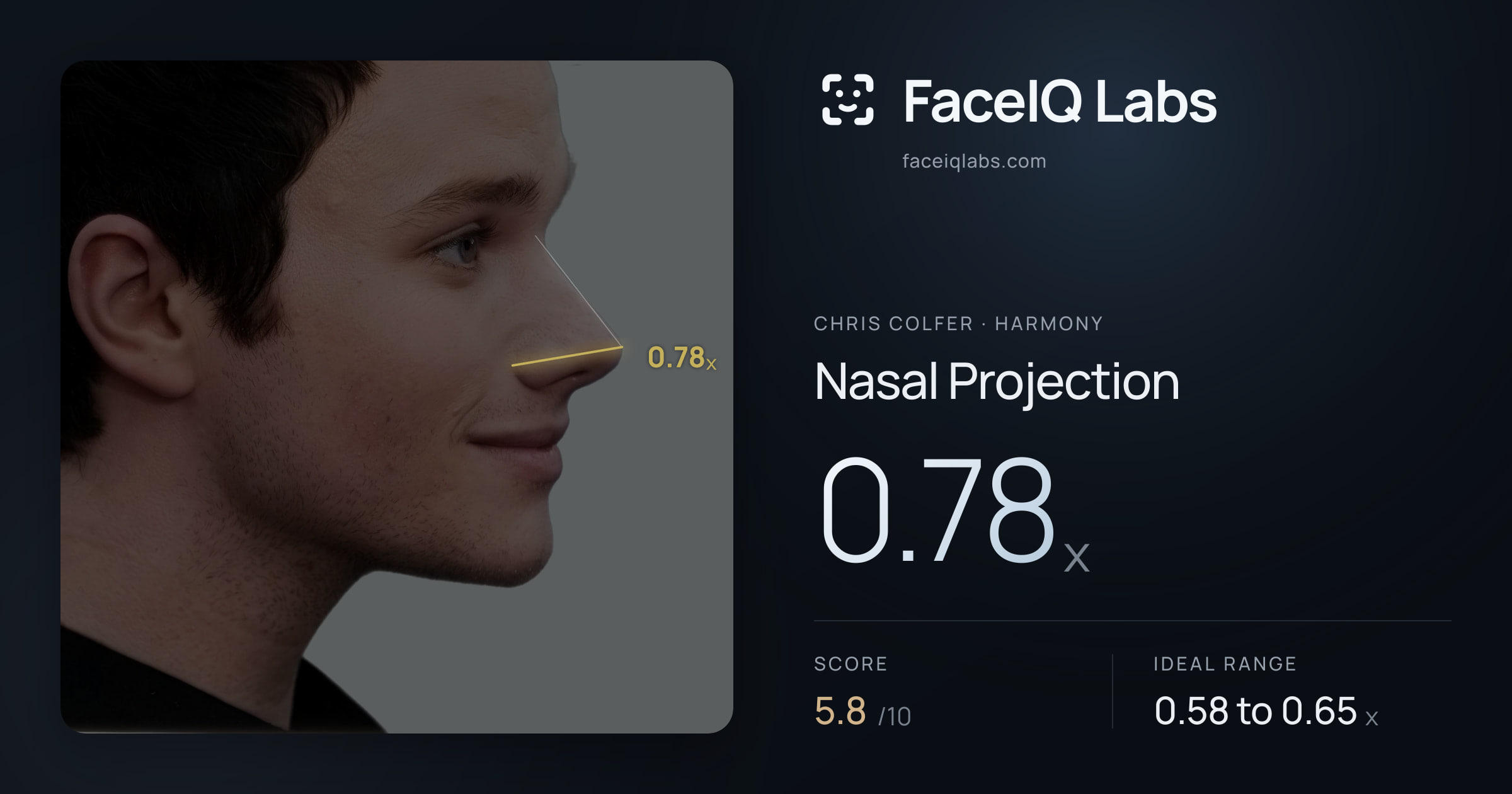 Chris Colfer Nasal Projection: 0.78x, drawn on the photo