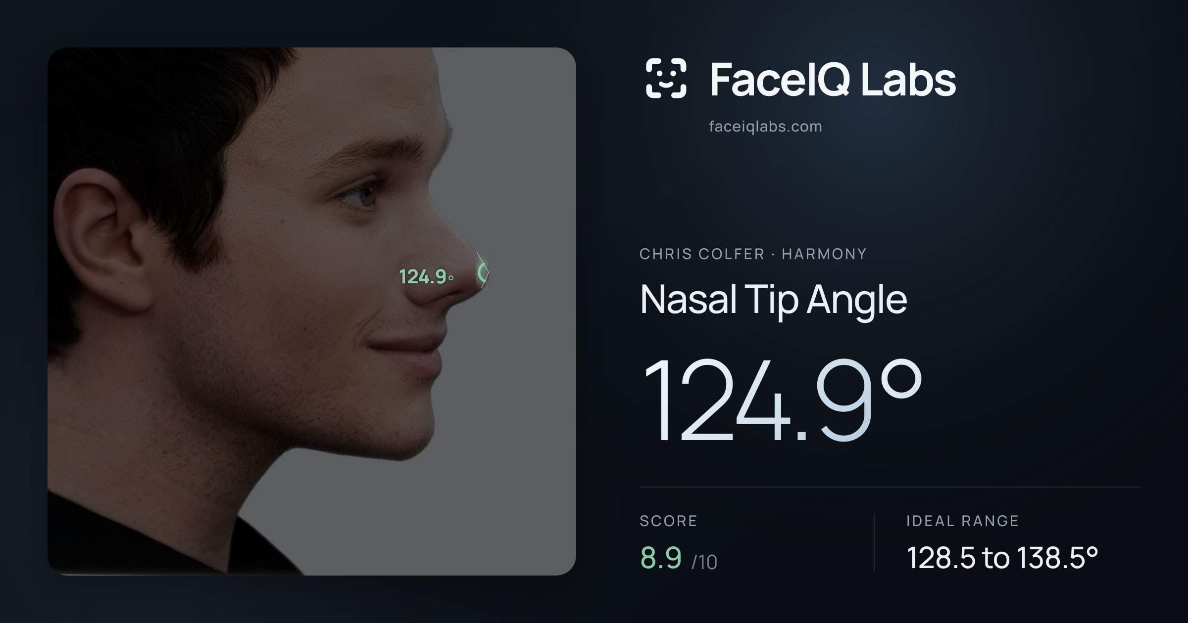 Chris Colfer Nasal Tip Angle: 124.9°, drawn on the photo