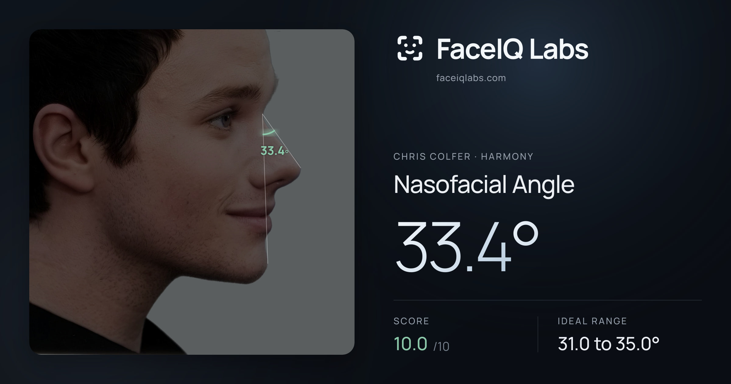 Chris Colfer Nasofacial Angle: 33.4°, drawn on the photo