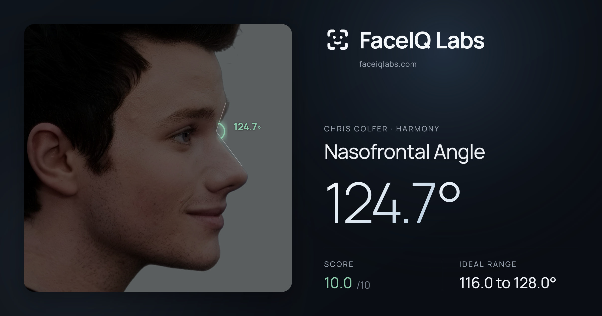 Chris Colfer Nasofrontal Angle: 124.7°, drawn on the photo