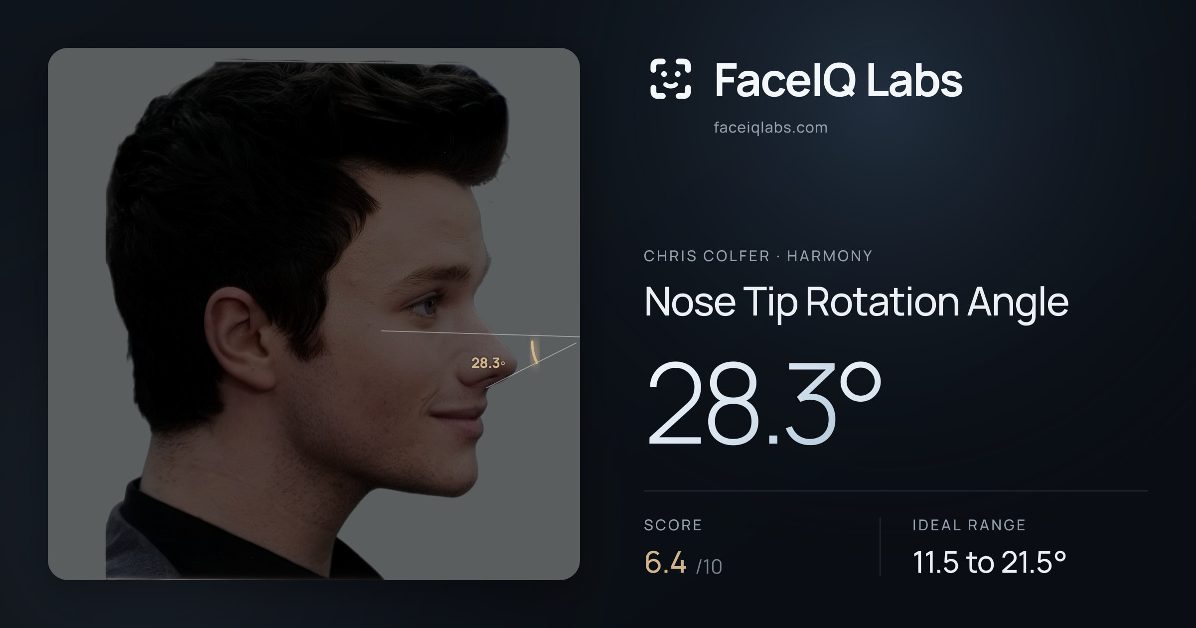 Chris Colfer Nose Tip Rotation Angle: 28.3°, drawn on the photo