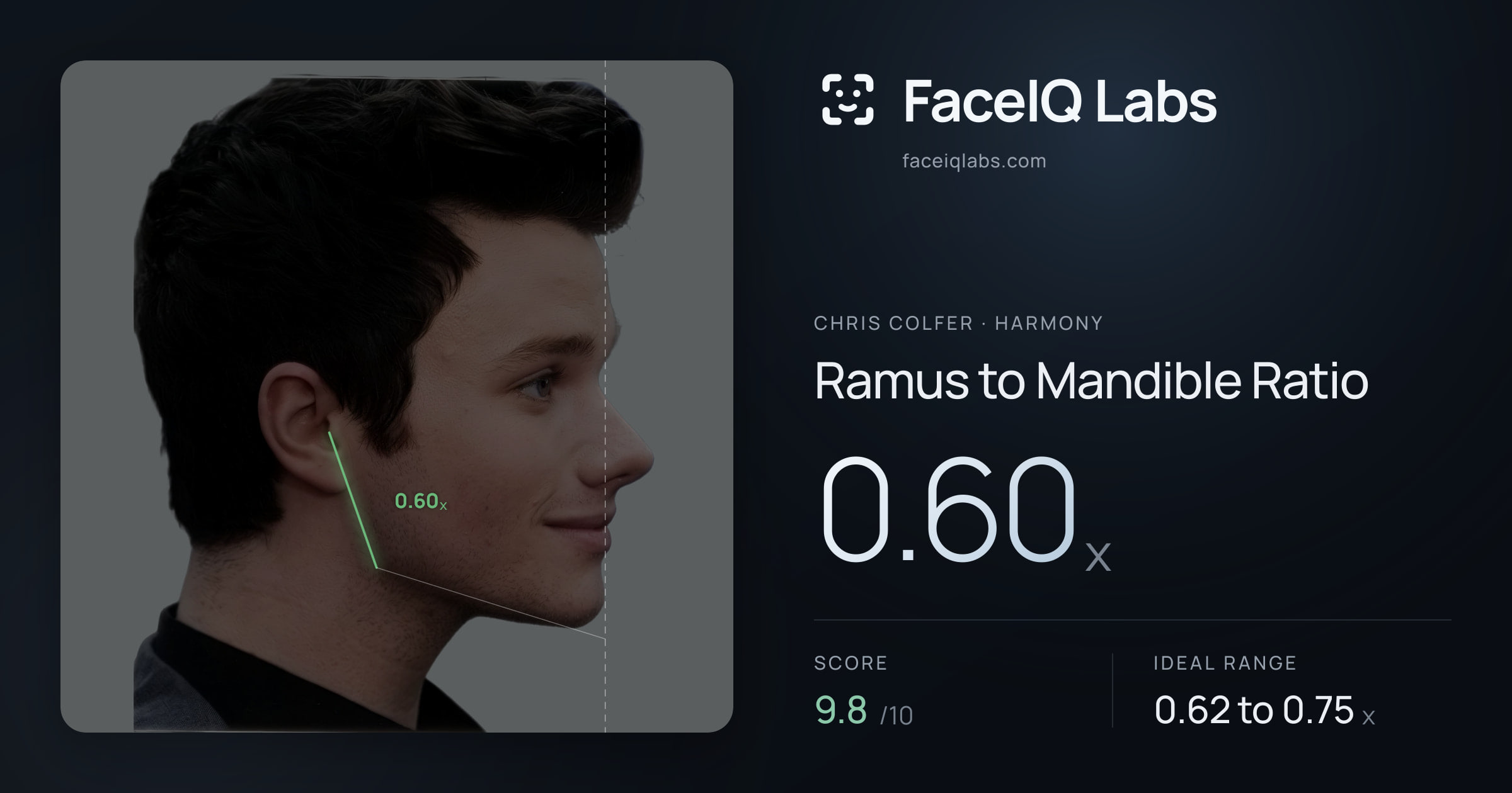 Chris Colfer Ramus to Mandible Ratio: 0.60x, drawn on the photo