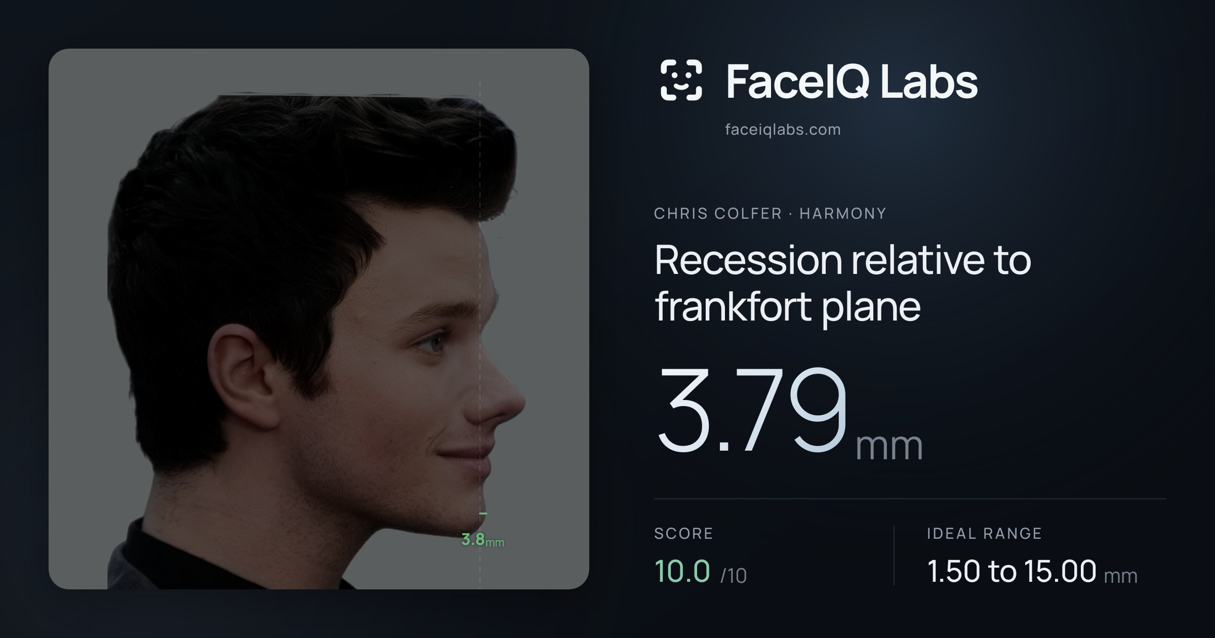 Chris Colfer Recession relative to frankfort plane: 3.79mm, drawn on the photo
